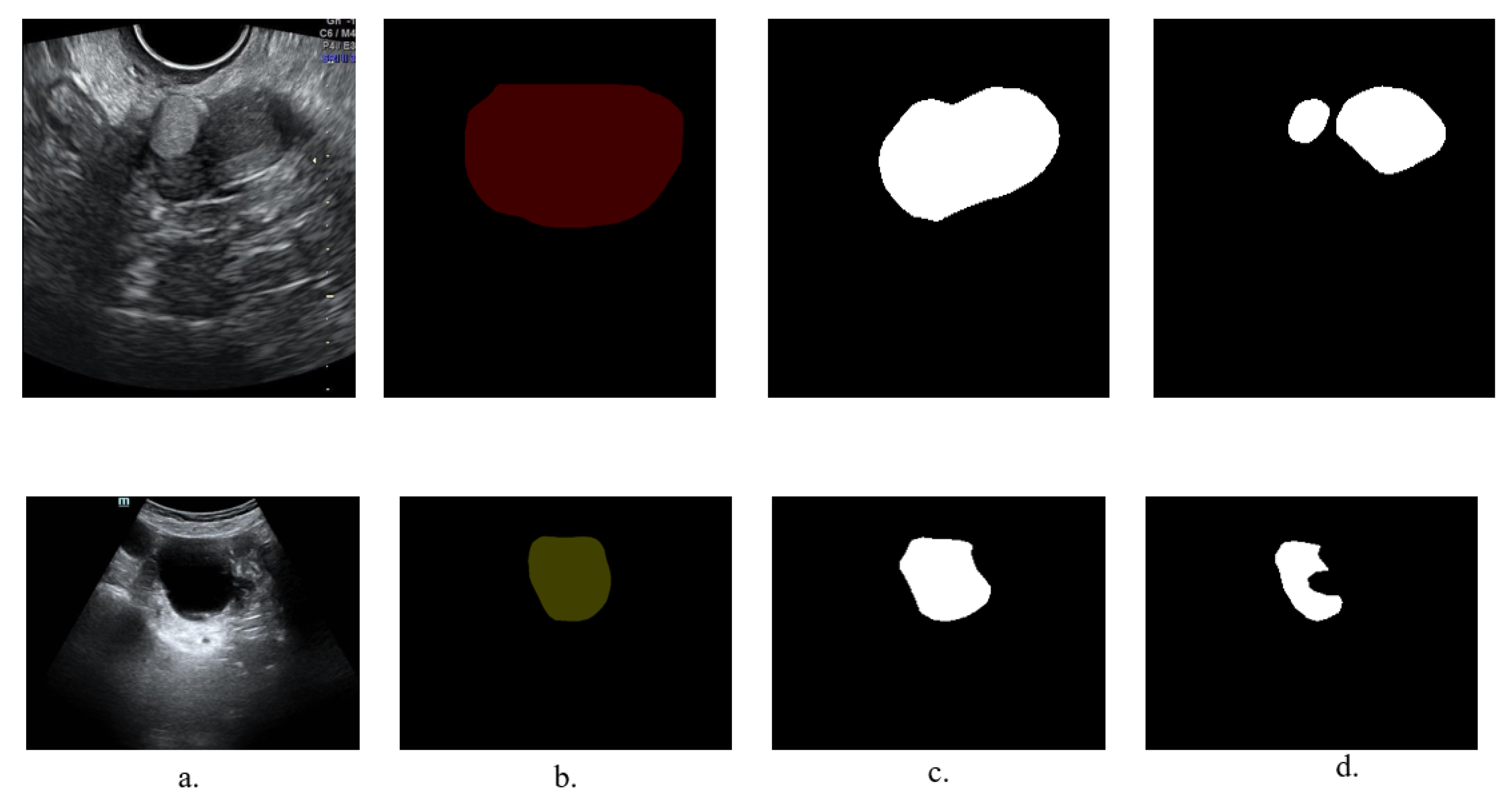 Bioengineering 10 00184 g010