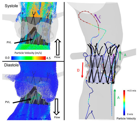 プレステーション Detection of inflammasome activation in liver tissue during