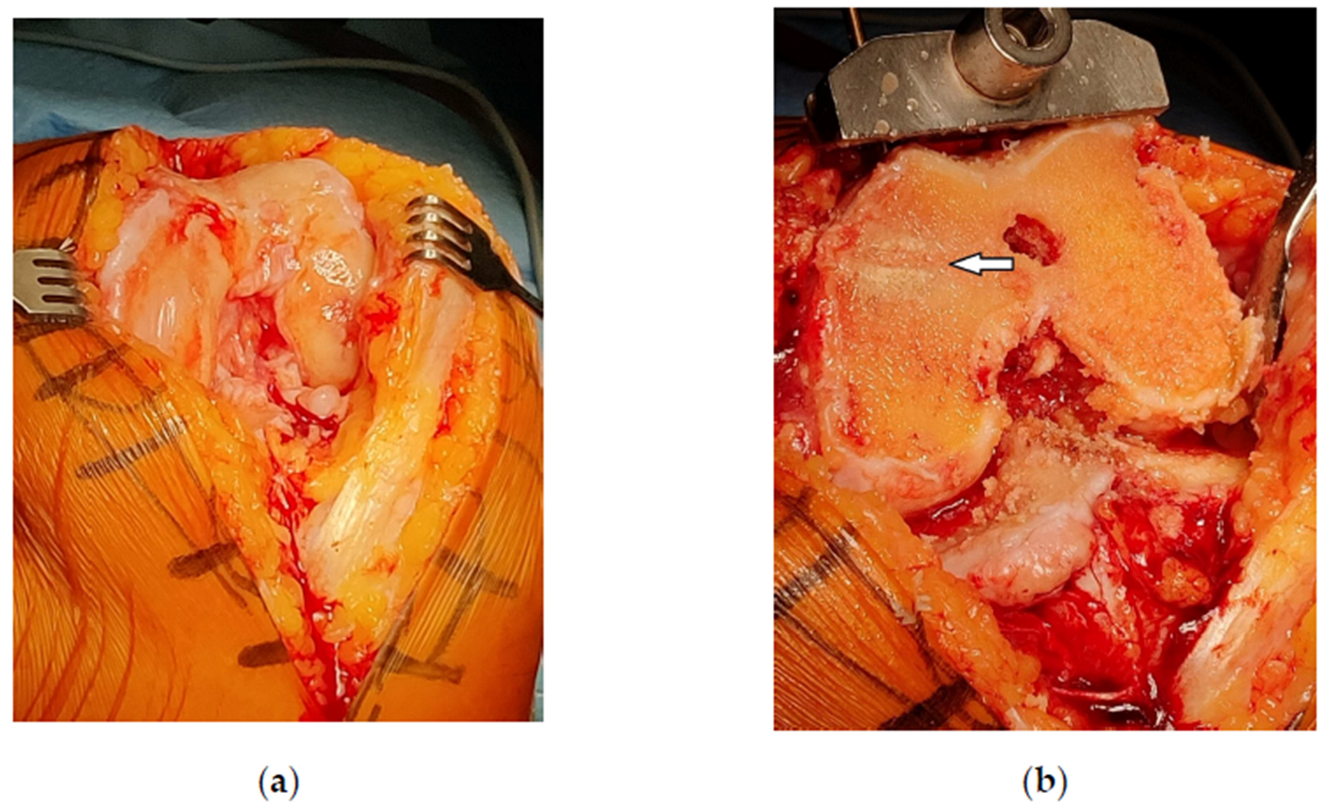 Bioengineering 10 00208 g004