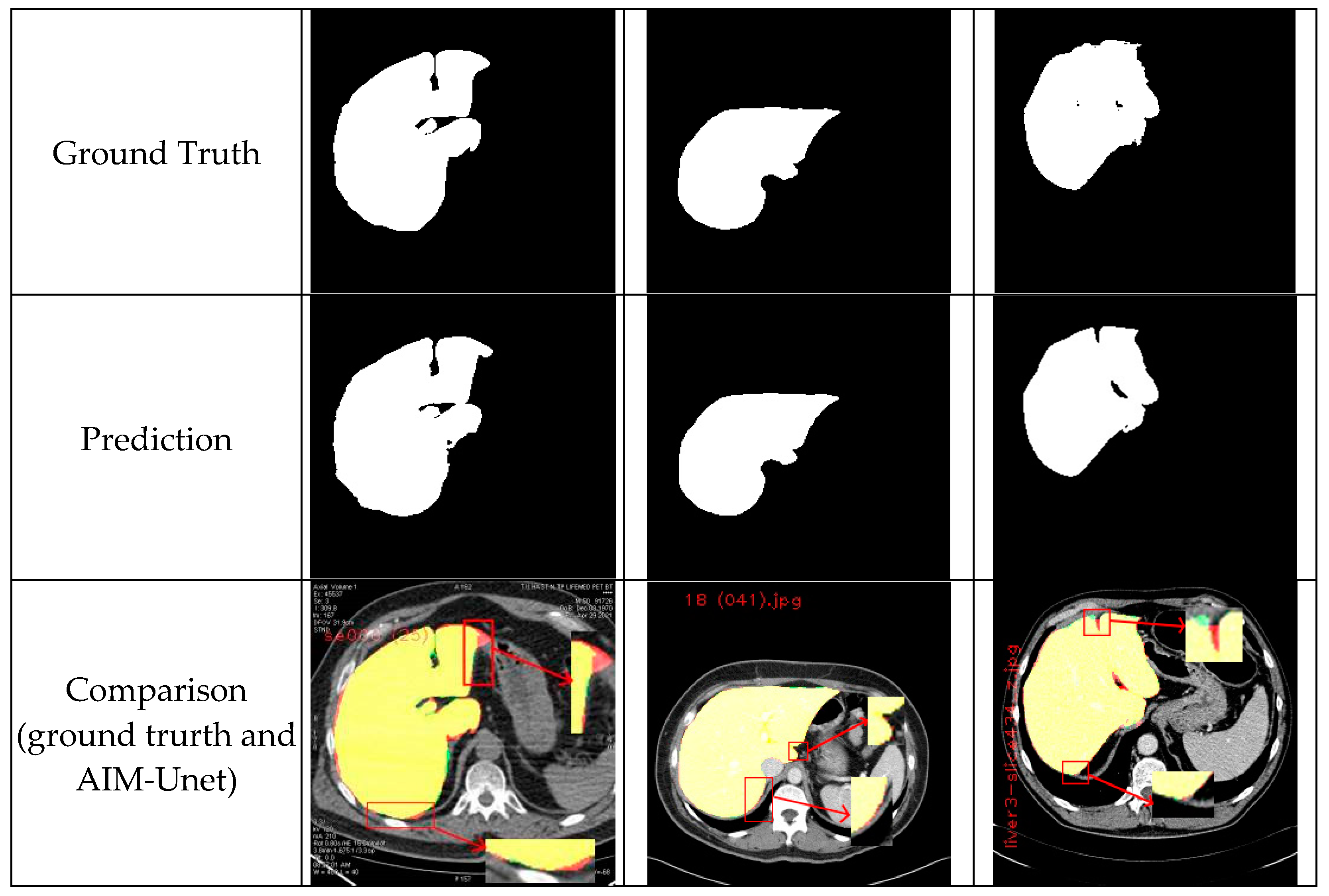 Bioengineering 10 00215 g008b Bioengineering 10 00215 g008b