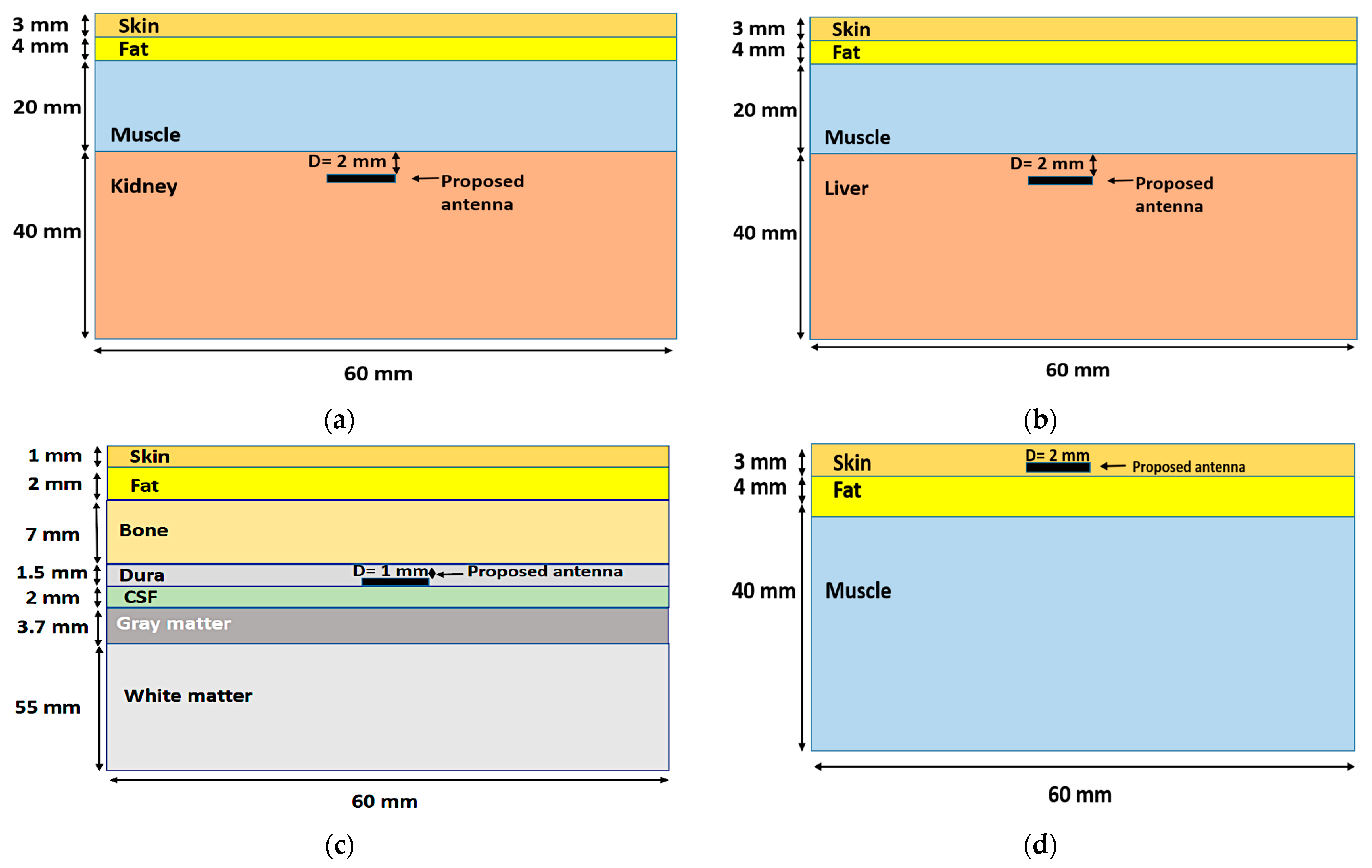 Bioengineering 10 00216 g011