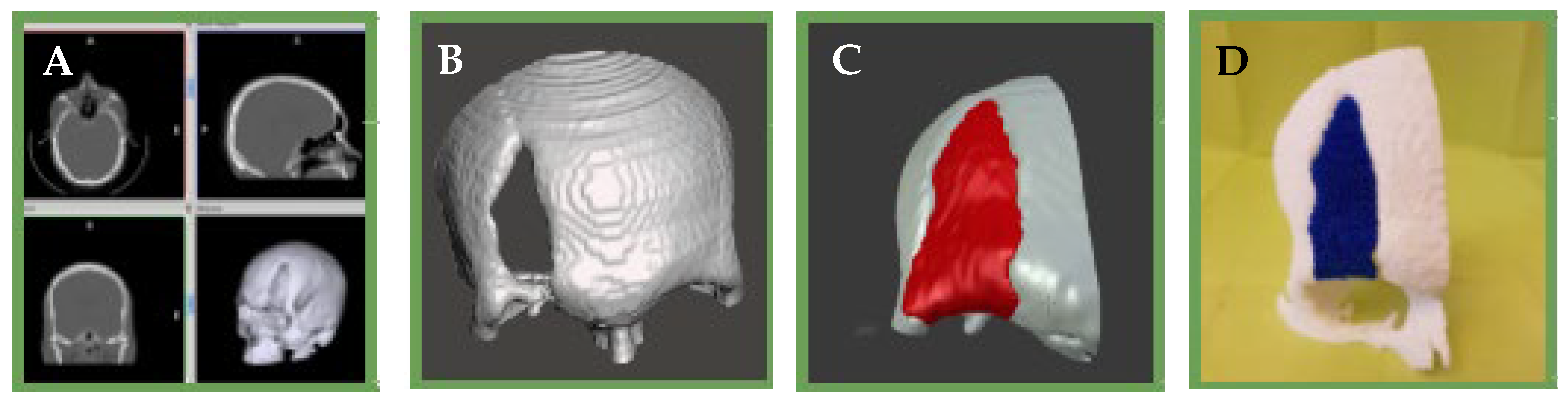 Bioengineering 10 00218 g013 Bioengineering 10 00218 g013
