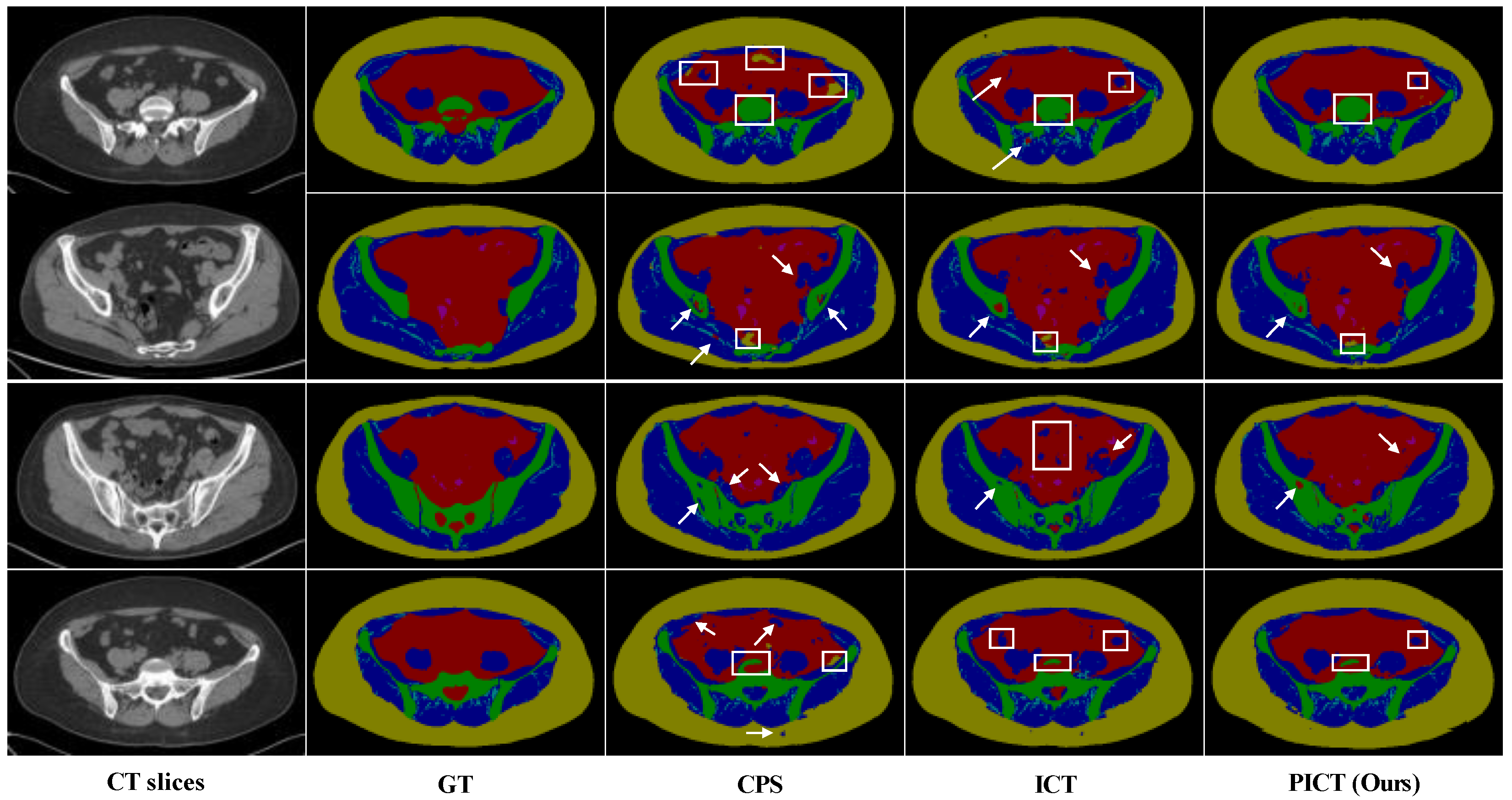 Bioengineering | Free Full-Text | Semi-Supervised Medical Image ...