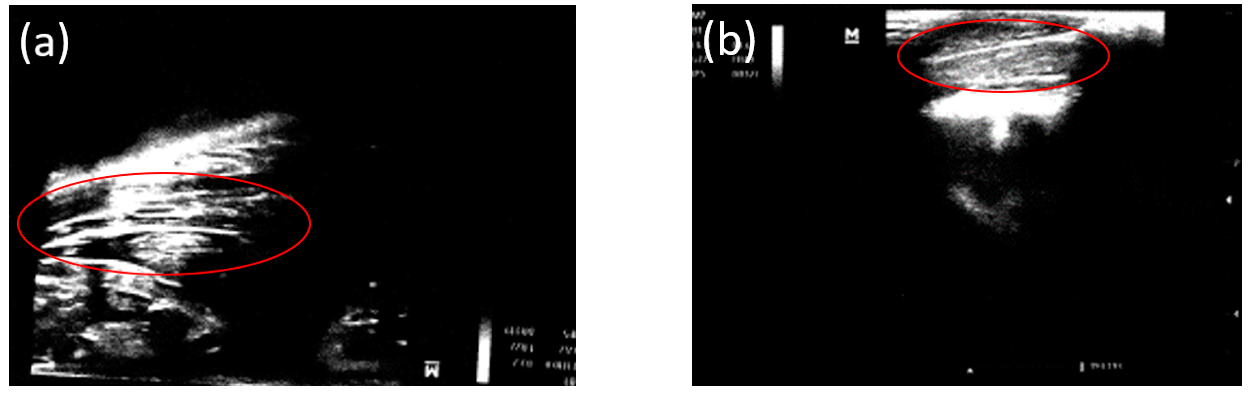 Bioengineering 10 00273 g006