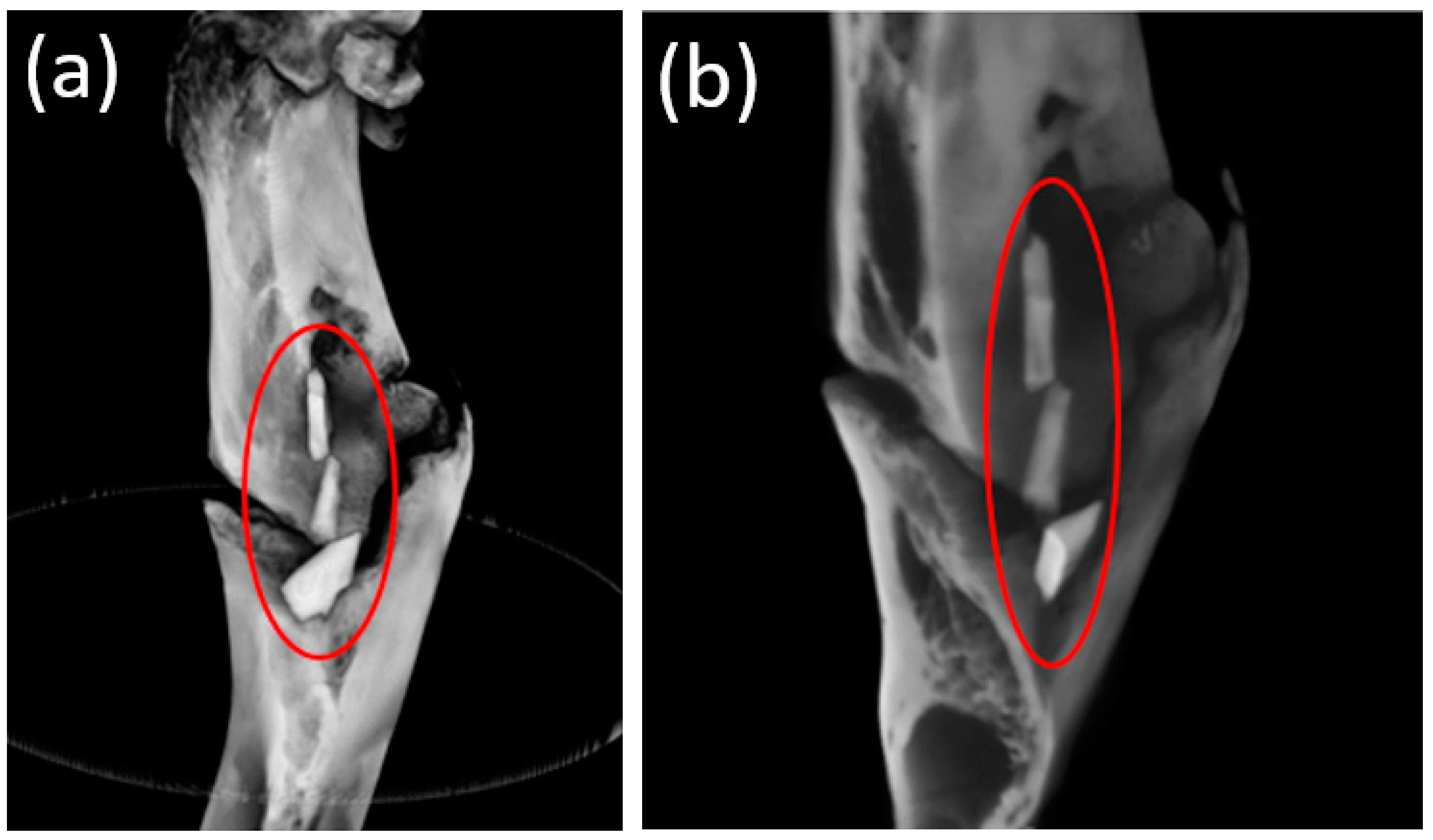 Bioengineering 10 00273 g012