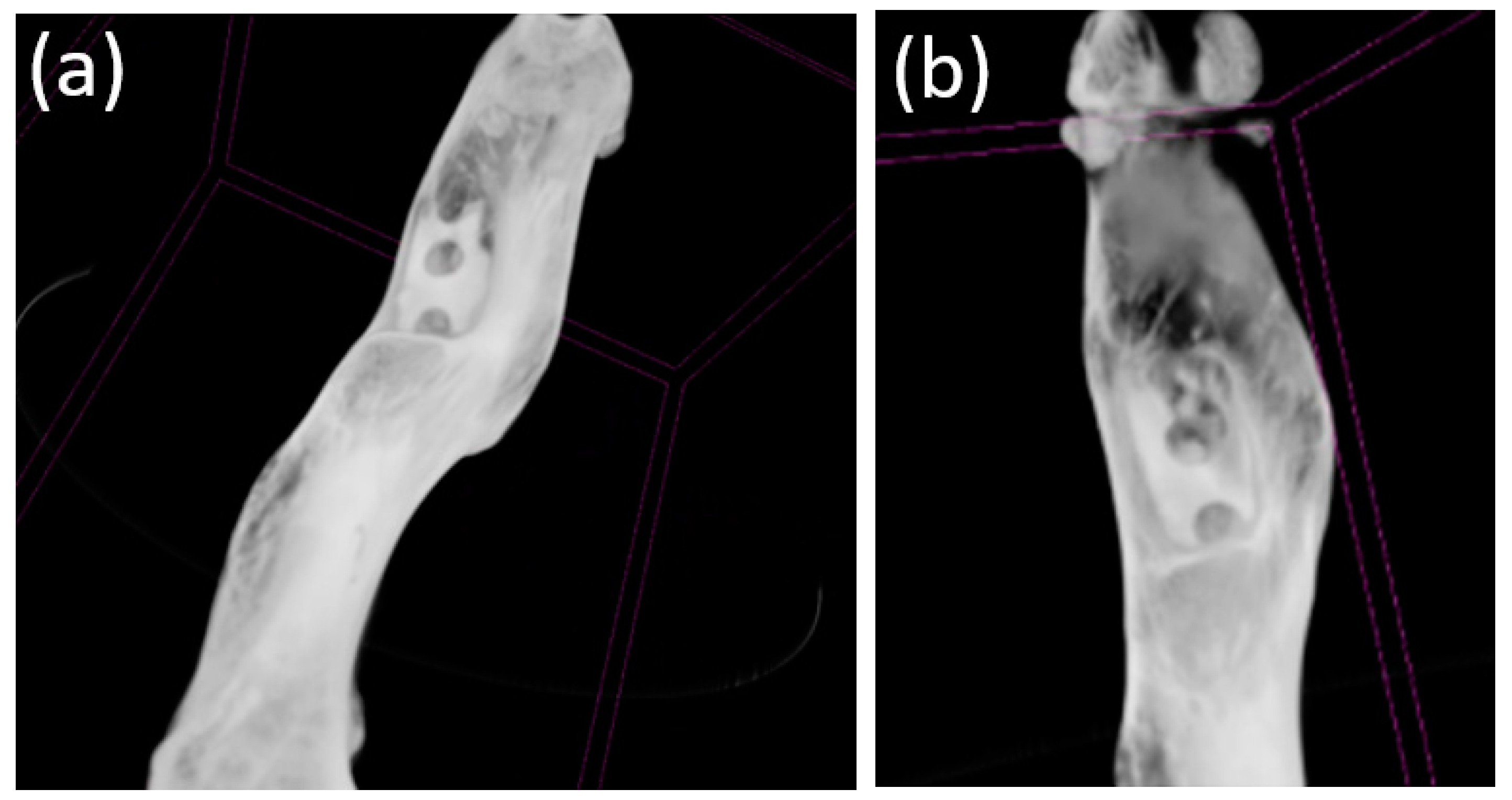 Bioengineering 10 00273 g013