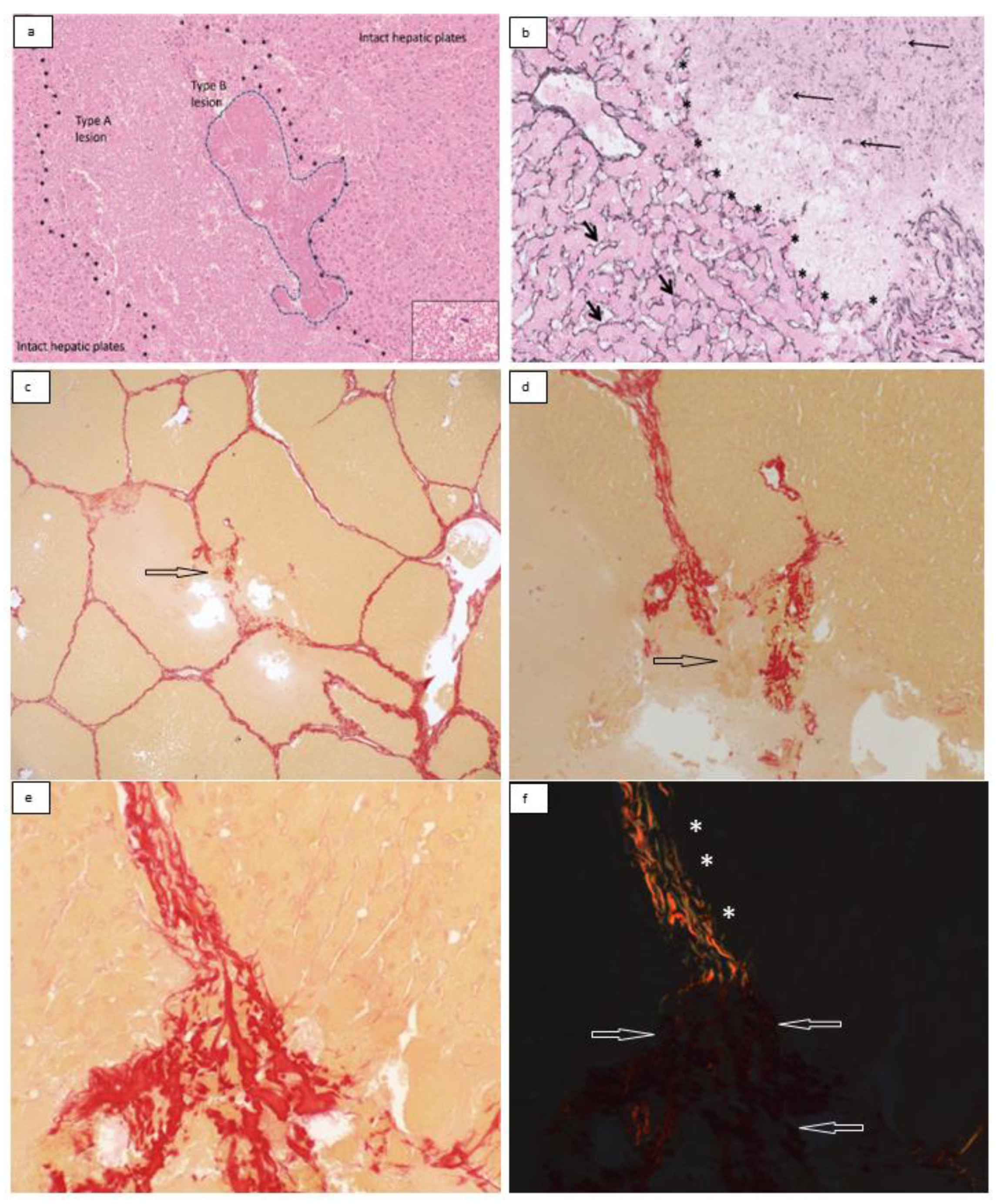 Bioengineering 10 00278 g004 Bioengineering 10 00278 g004