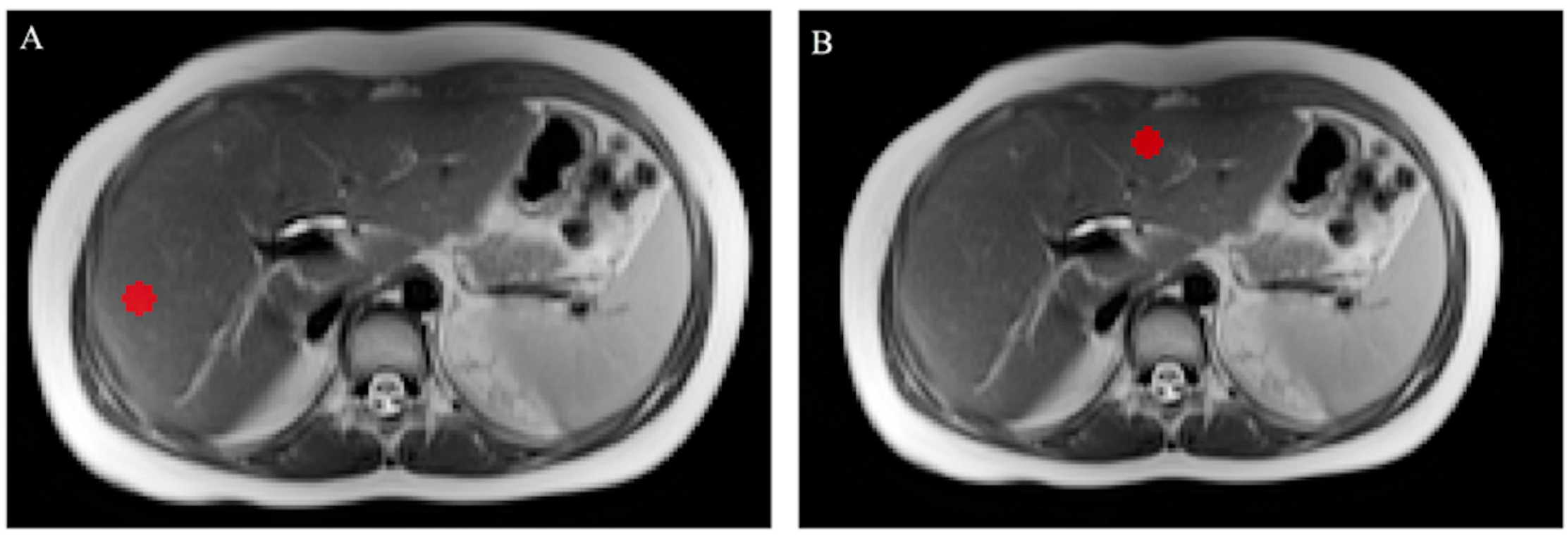 Bioengineering 10 00306 g002 Bioengineering 10 00306 g002