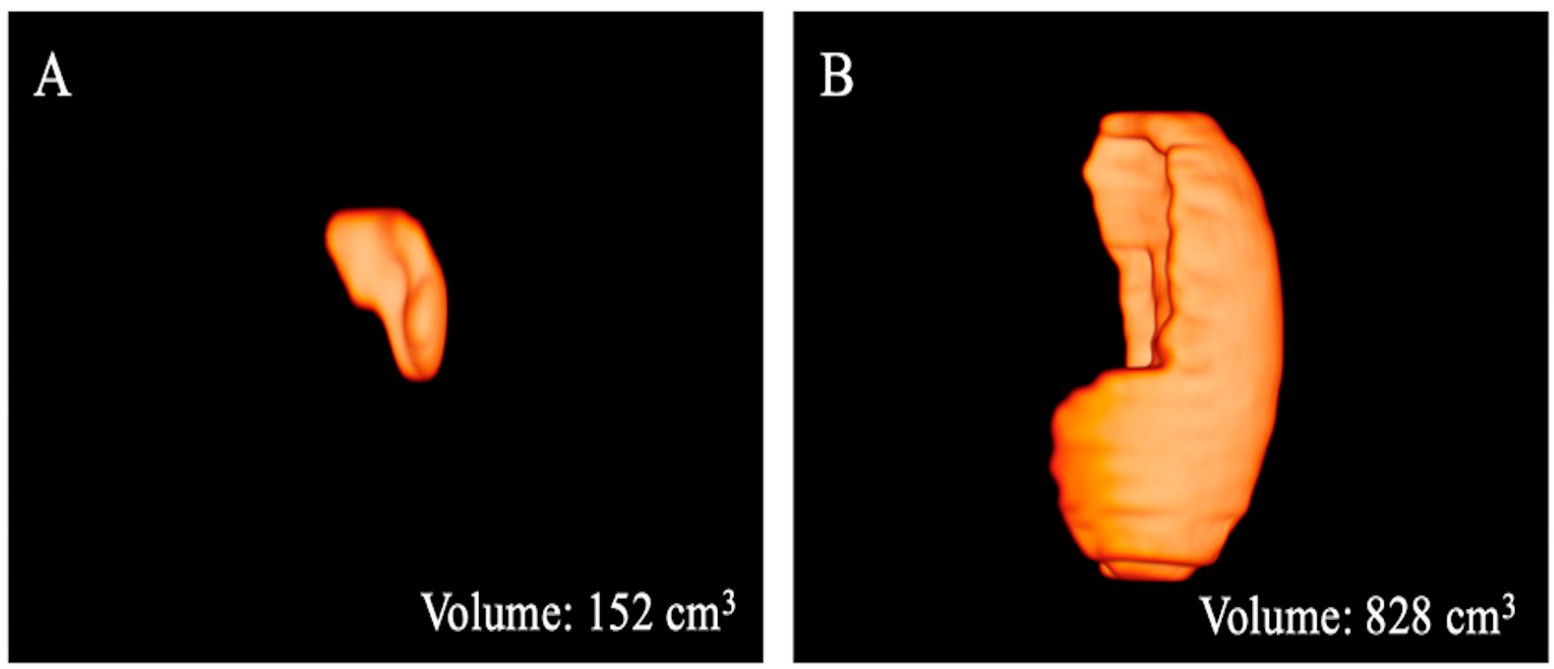 Bioengineering 10 00306 g004 Bioengineering 10 00306 g004