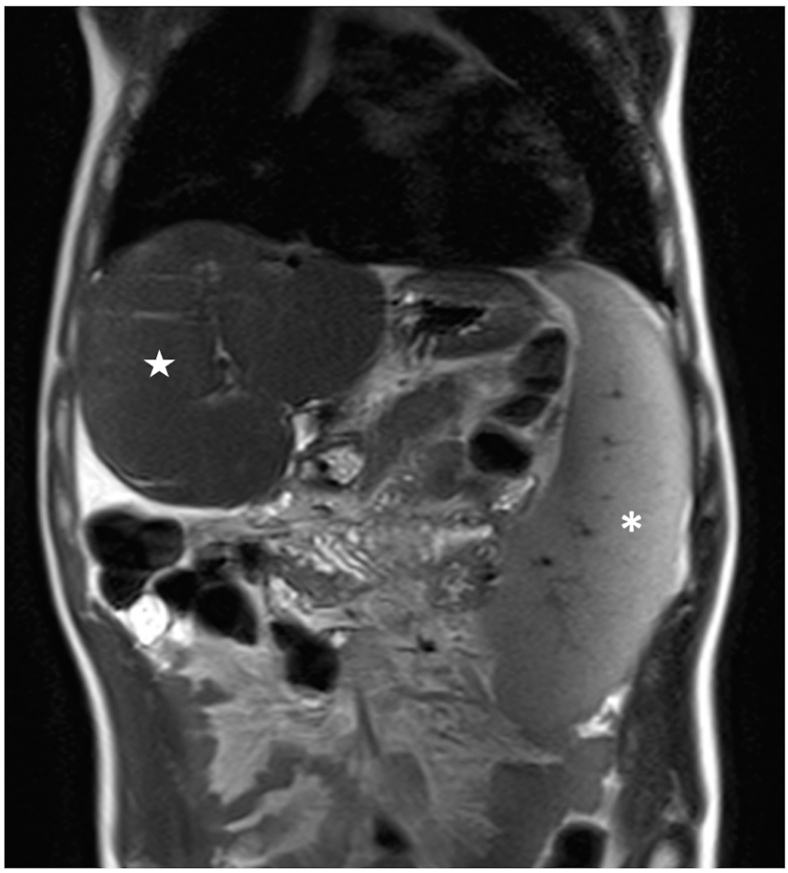 Bioengineering 10 00306 g005 Bioengineering 10 00306 g005