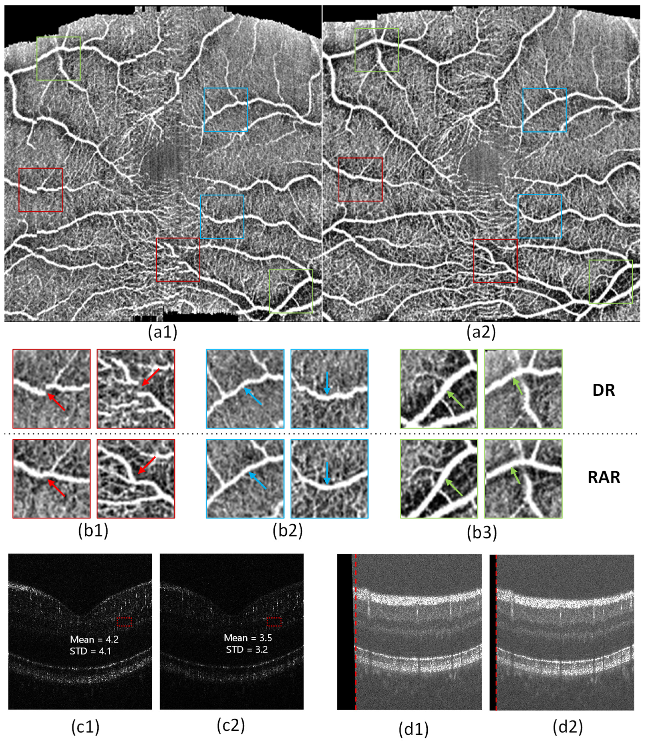 Bioengineering 10 00313 g010