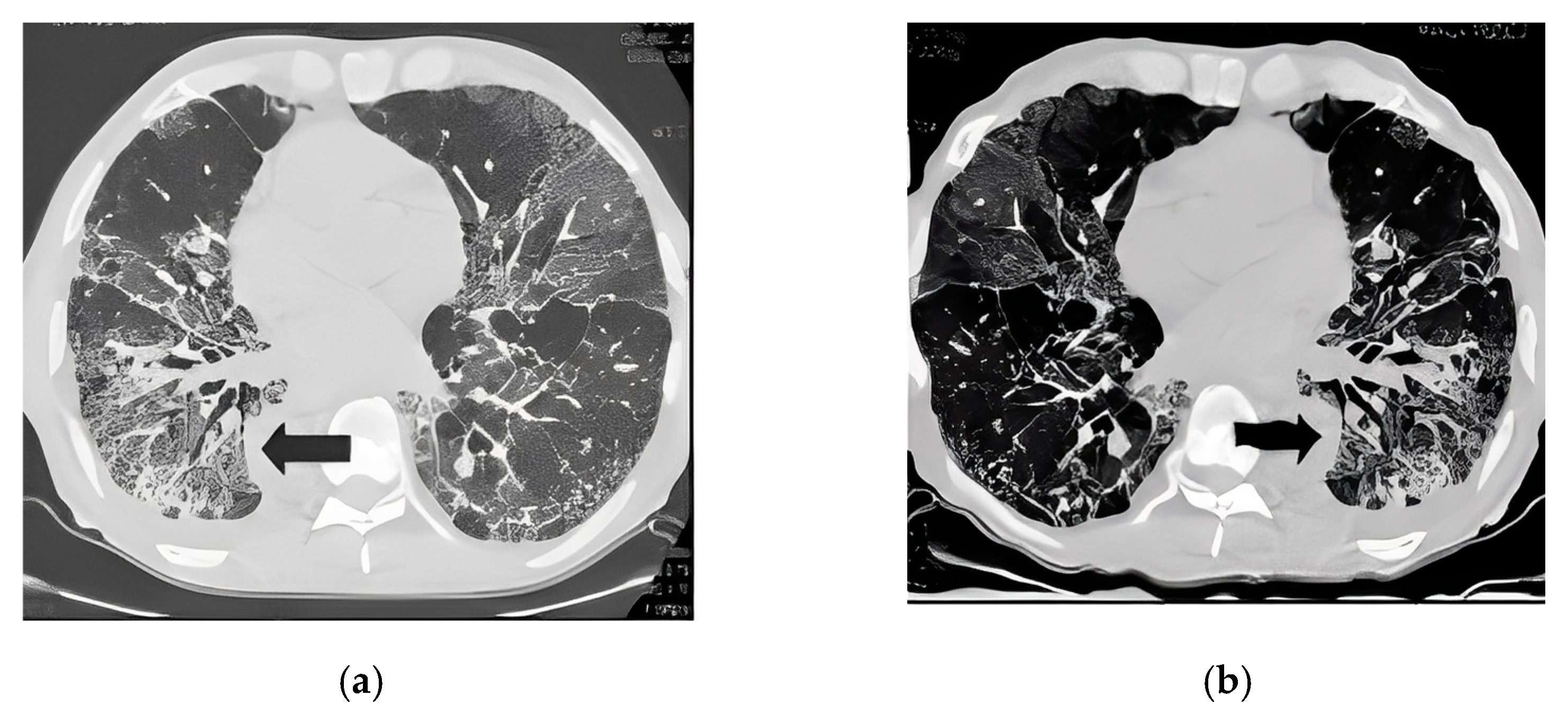 Bioengineering 10 00321 g001 Bioengineering 10 00321 g001
