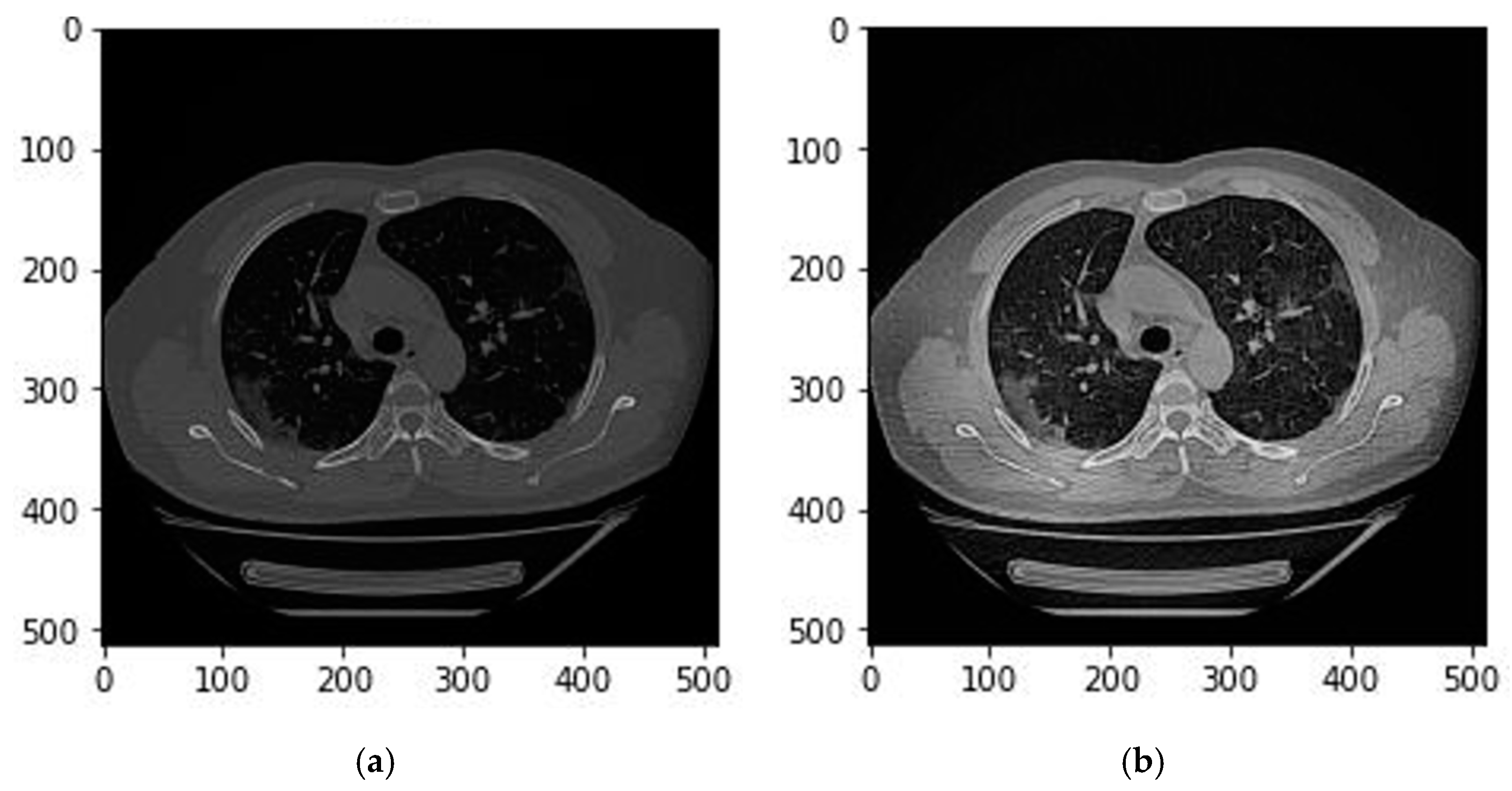 Bioengineering 10 00321 g002 Bioengineering 10 00321 g002