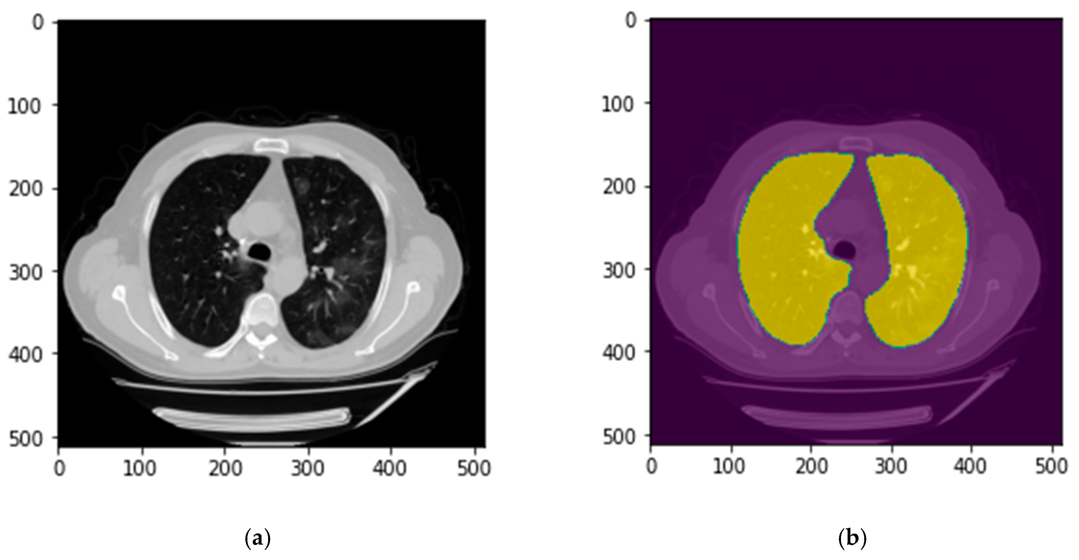 Bioengineering 10 00321 g003 Bioengineering 10 00321 g003