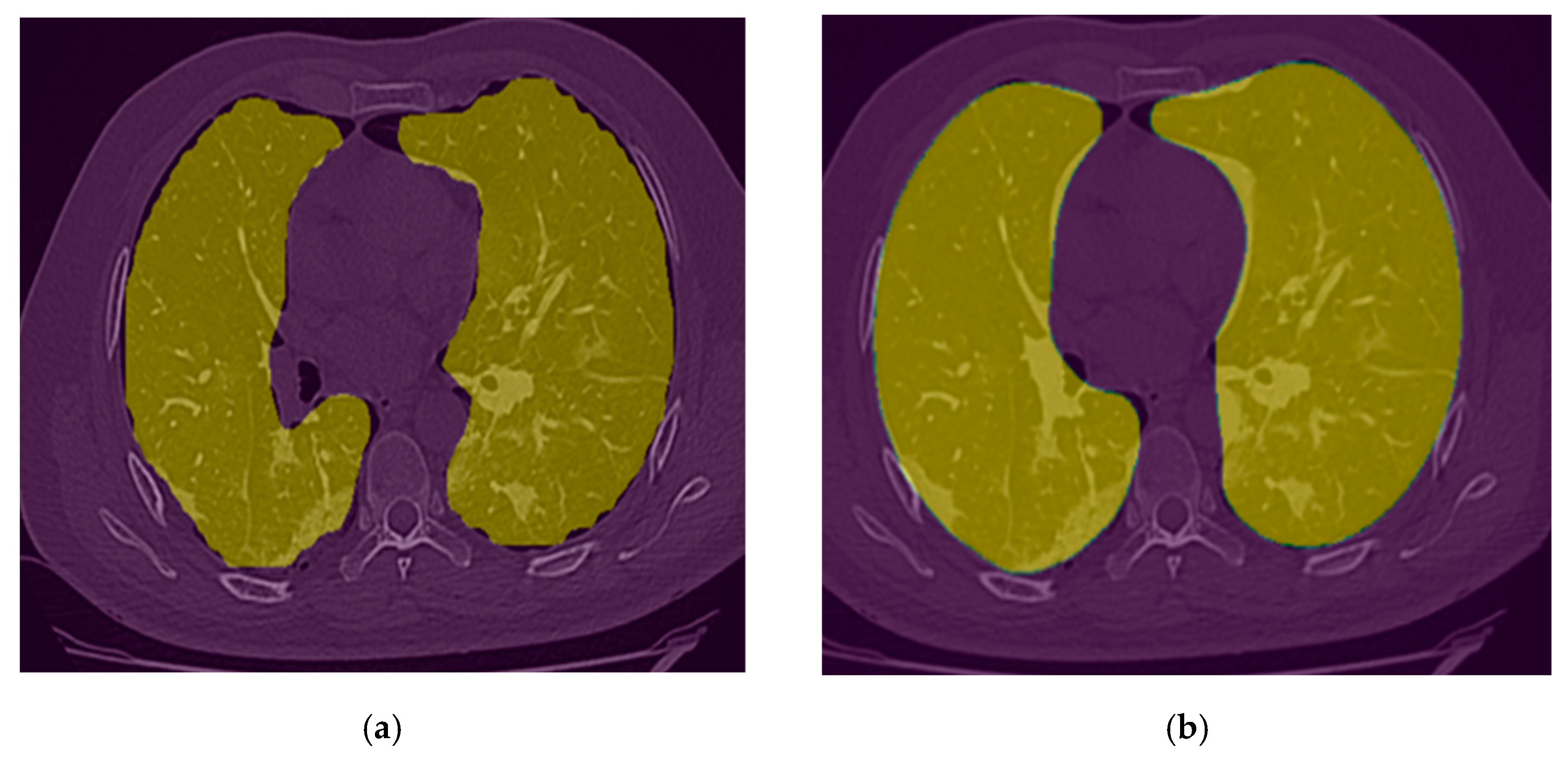 Bioengineering 10 00321 g006 Bioengineering 10 00321 g006