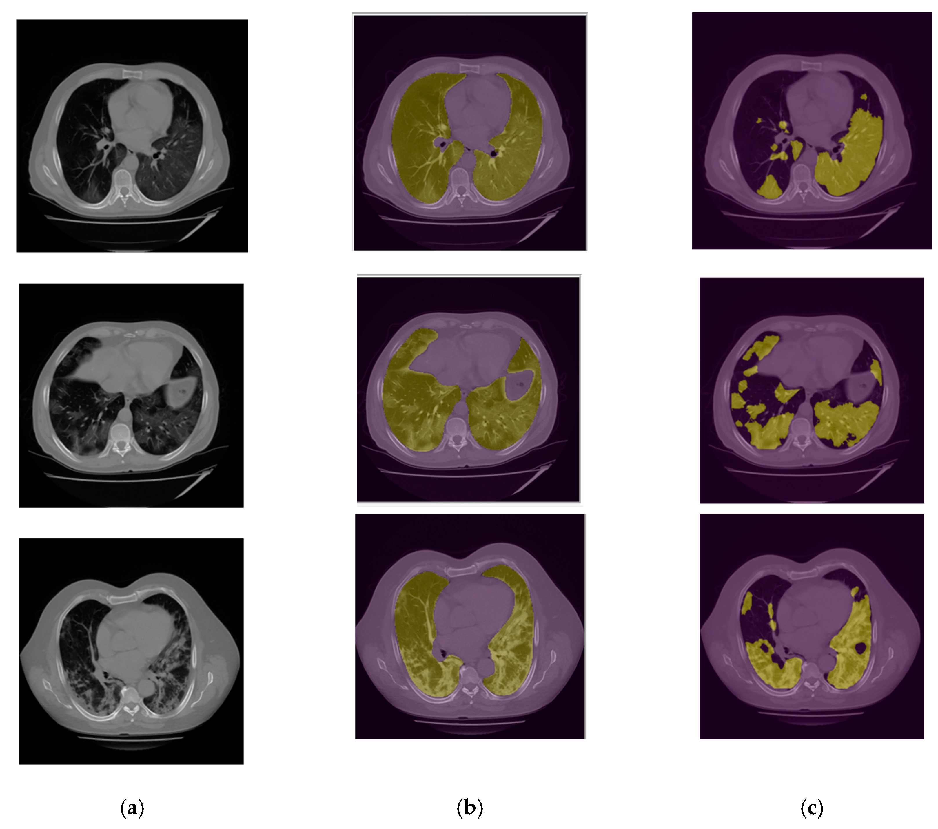 Bioengineering 10 00321 g007 Bioengineering 10 00321 g007