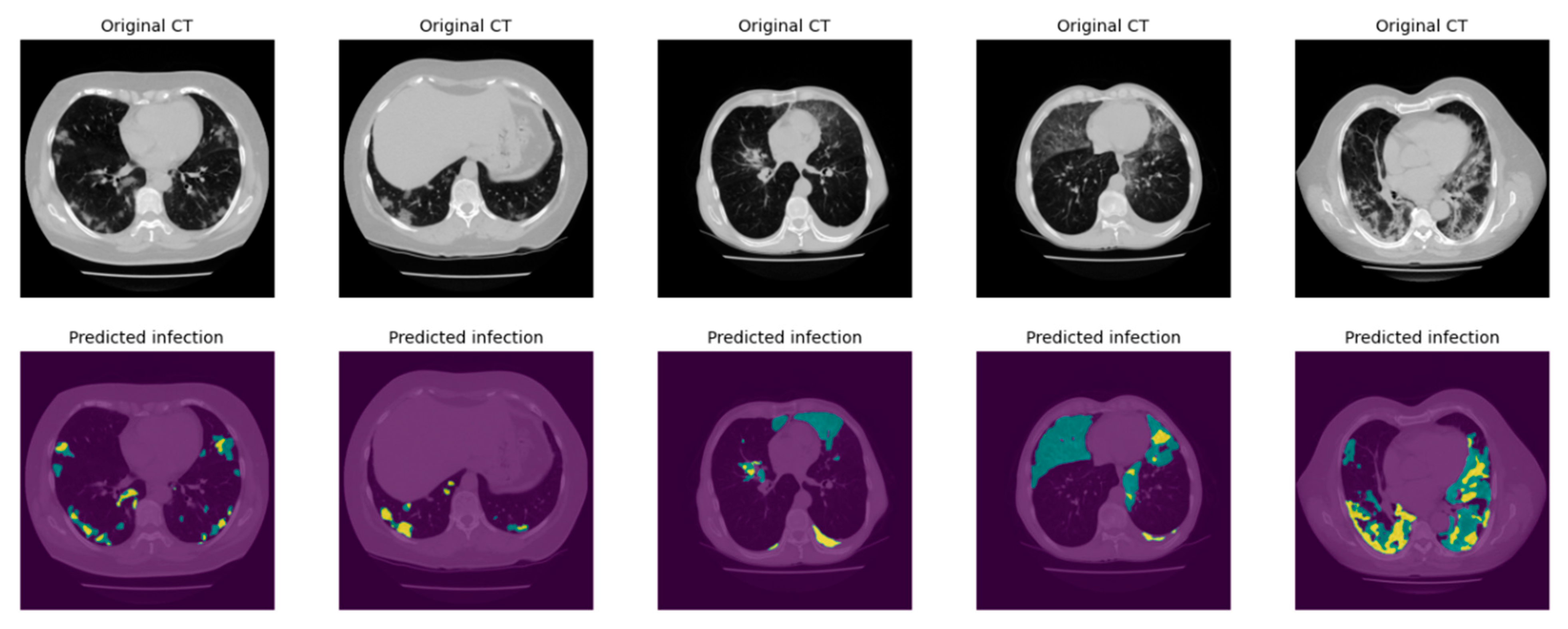 Bioengineering 10 00321 g008 Bioengineering 10 00321 g008