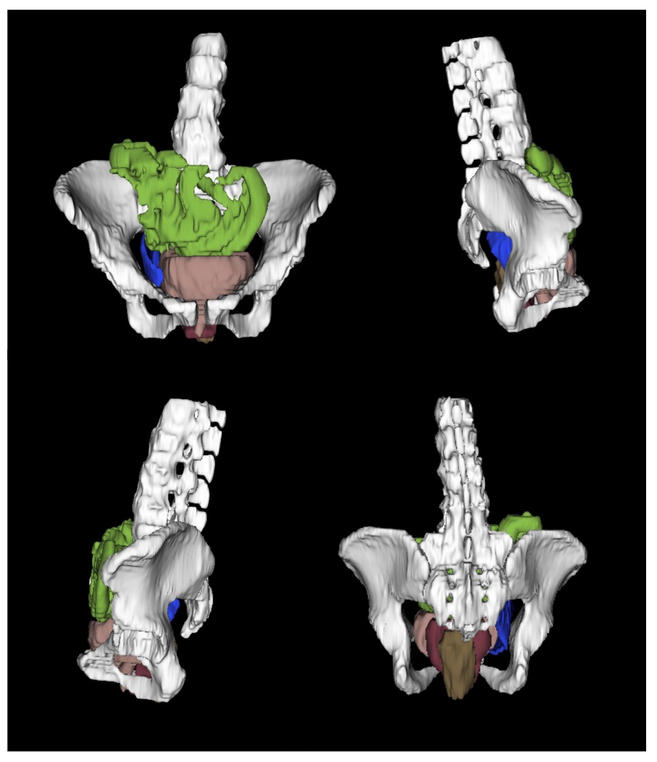 Bioengineering 10 00329 g002