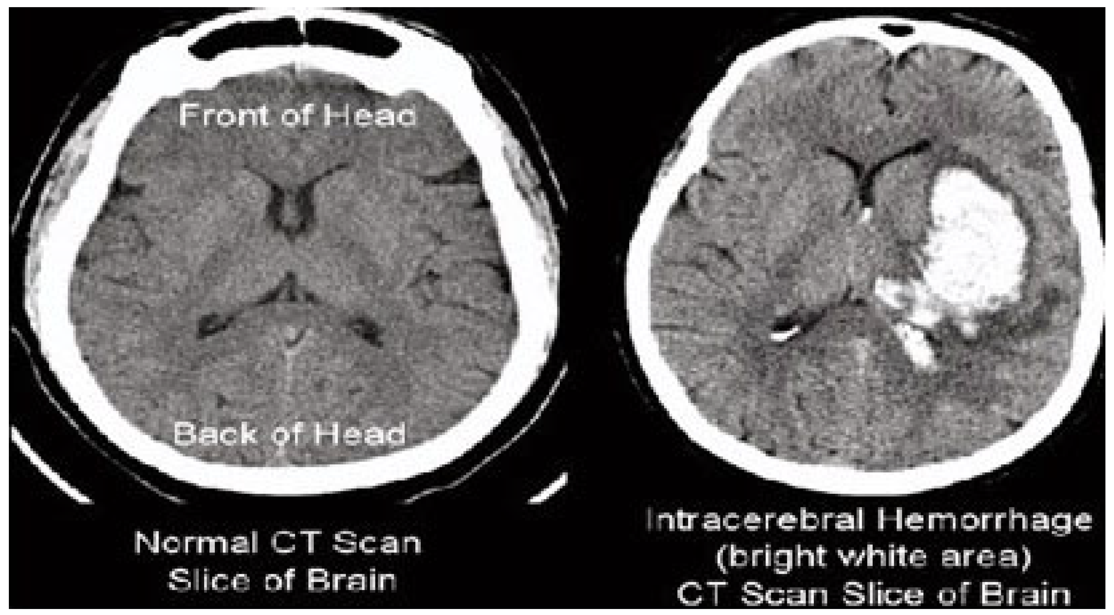 Bioengineering 10 00333 g002