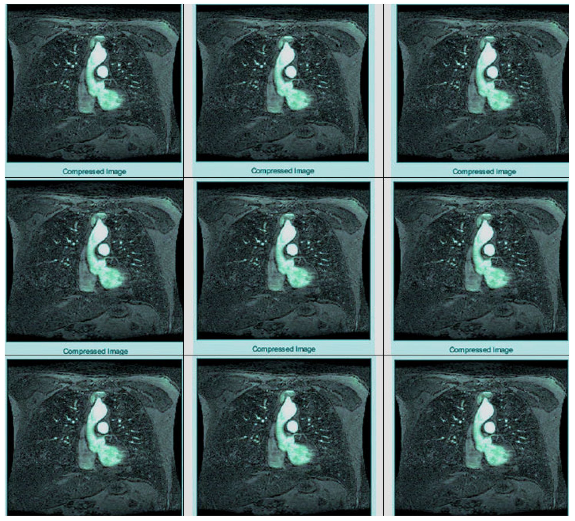 Bioengineering 10 00333 g007