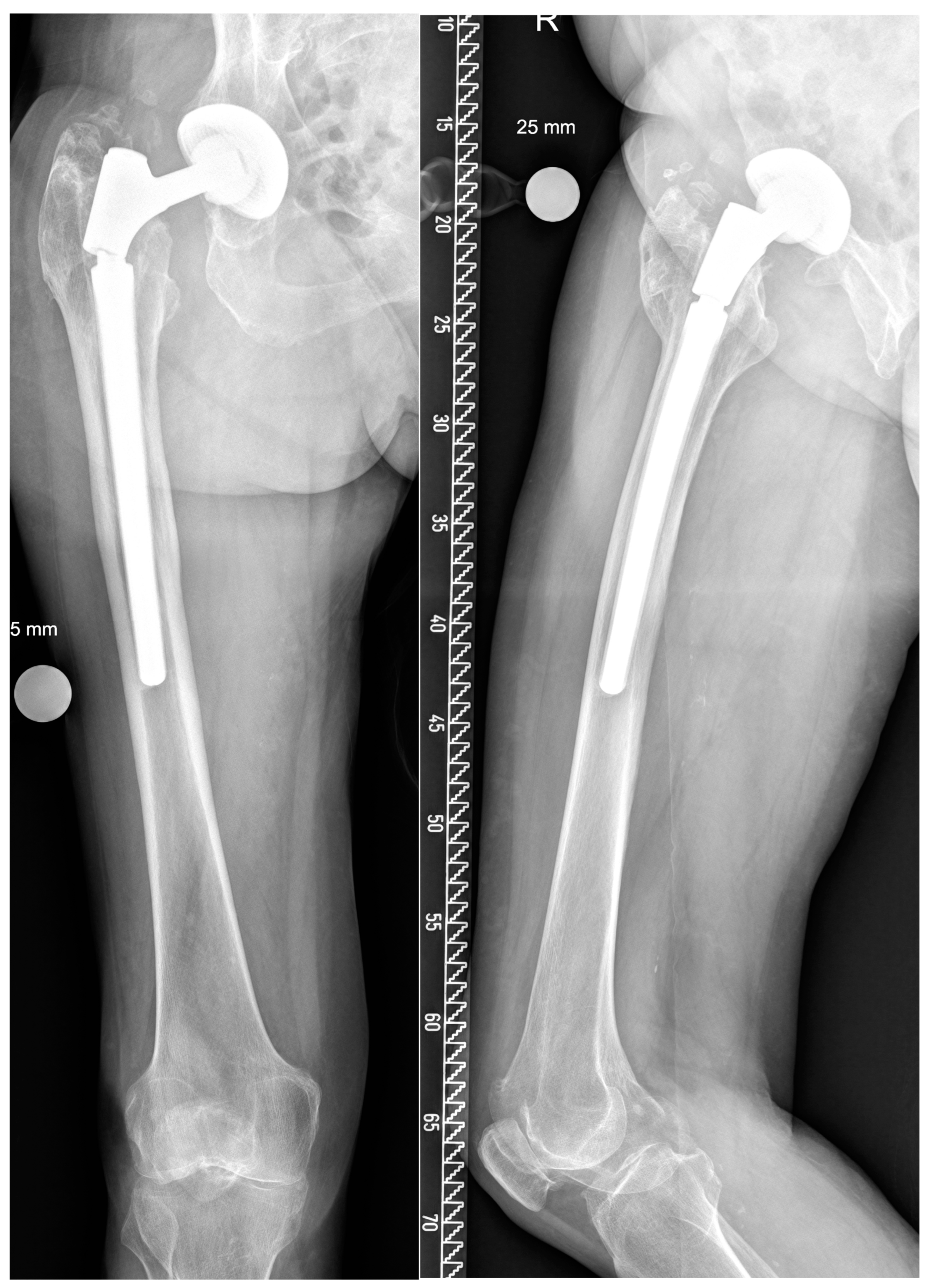 Bioengineering 10 00341 g006 Bioengineering 10 00341 g006