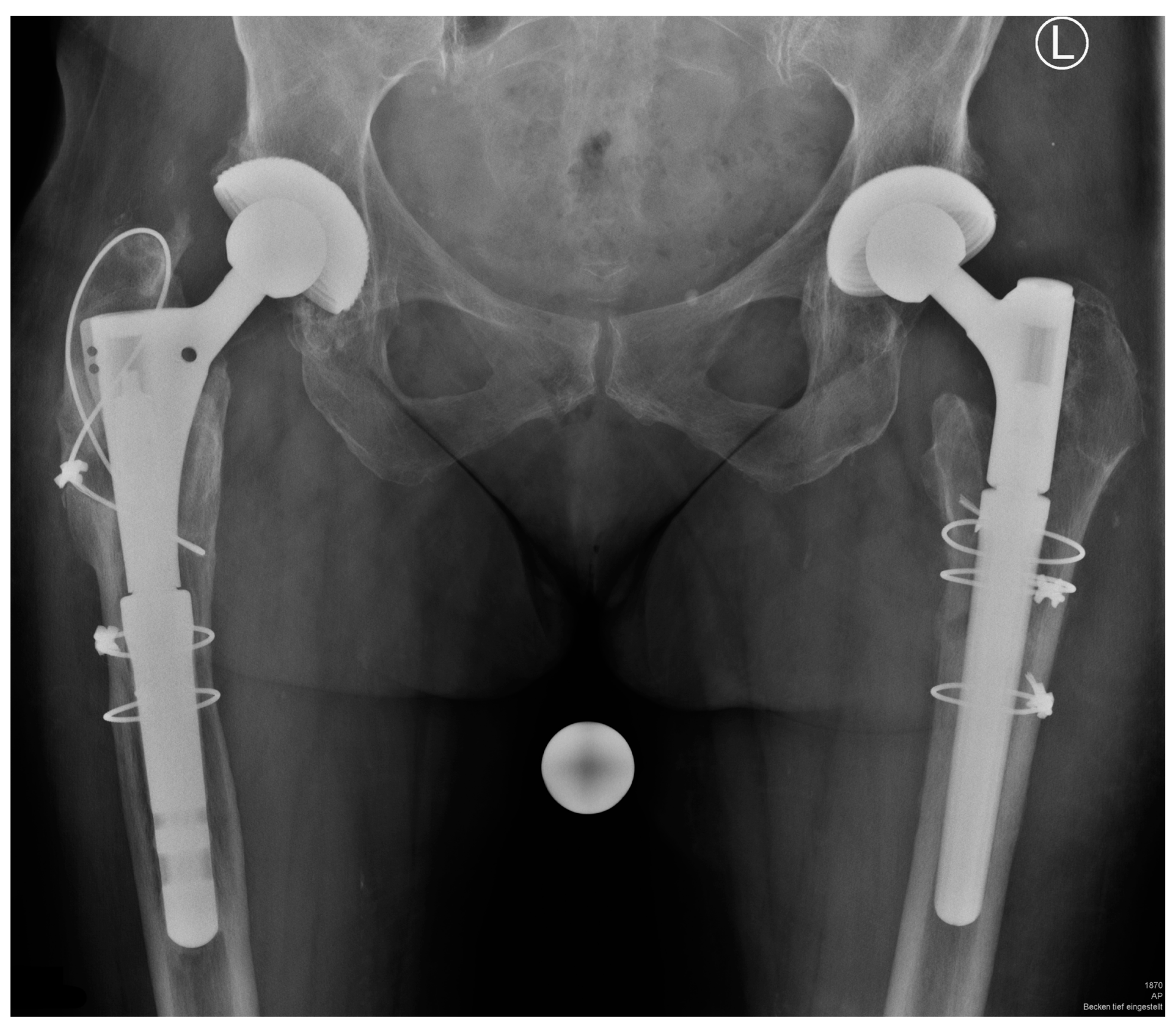 Bioengineering 10 00341 g007 Bioengineering 10 00341 g007