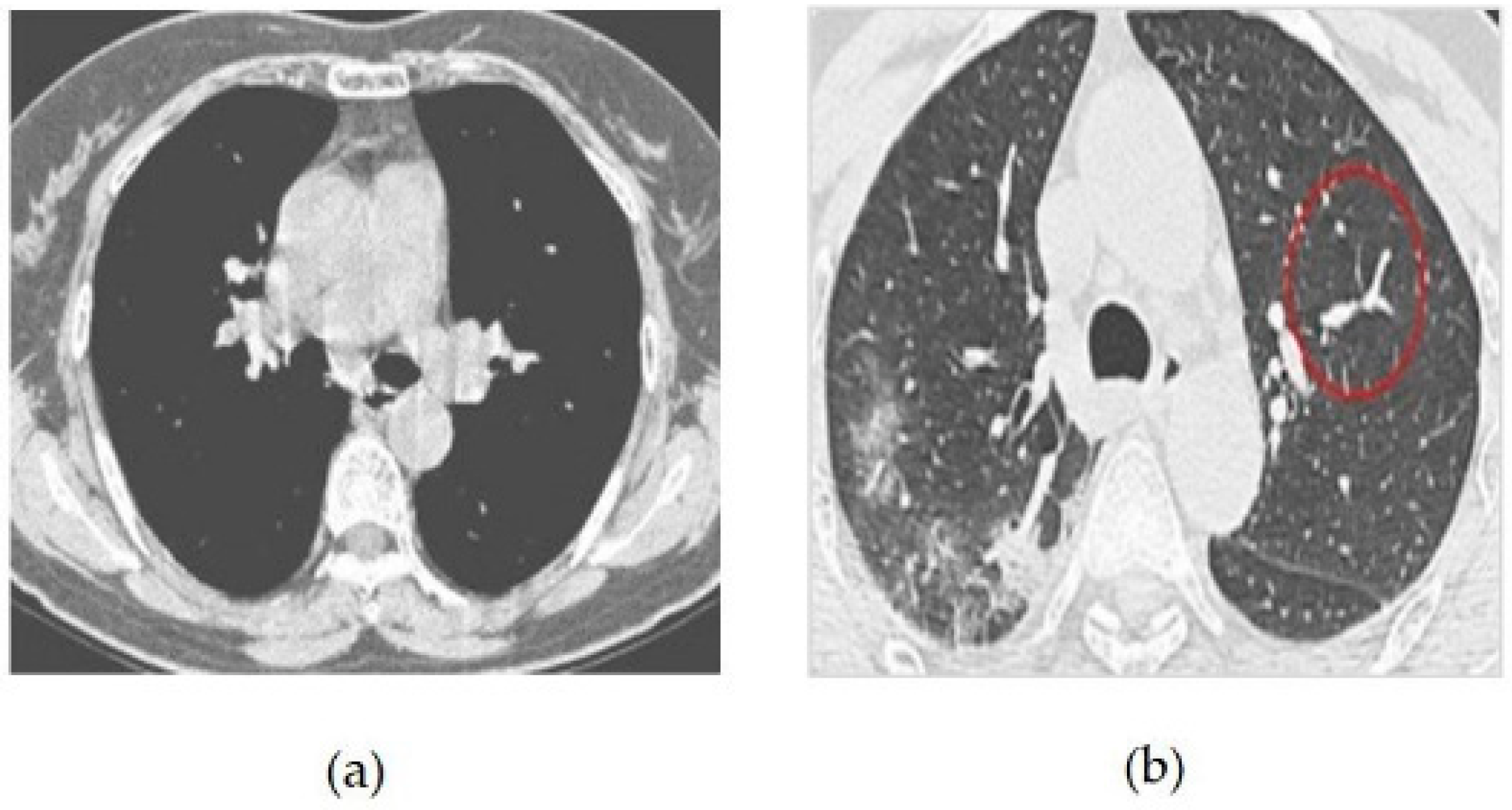Bioengineering 10 00363 g004