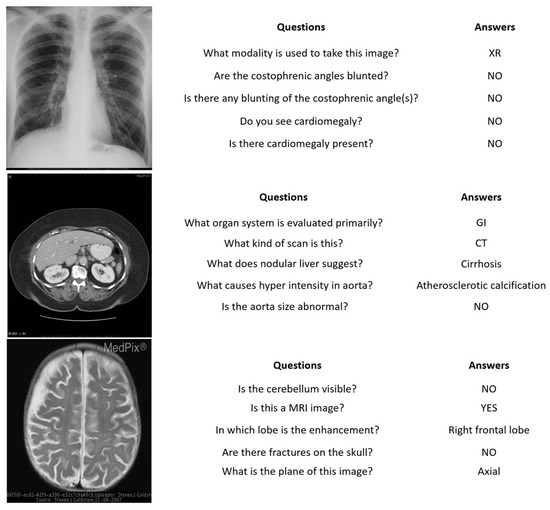 Bioengineering Free FullText VisionLanguage Model for Visual