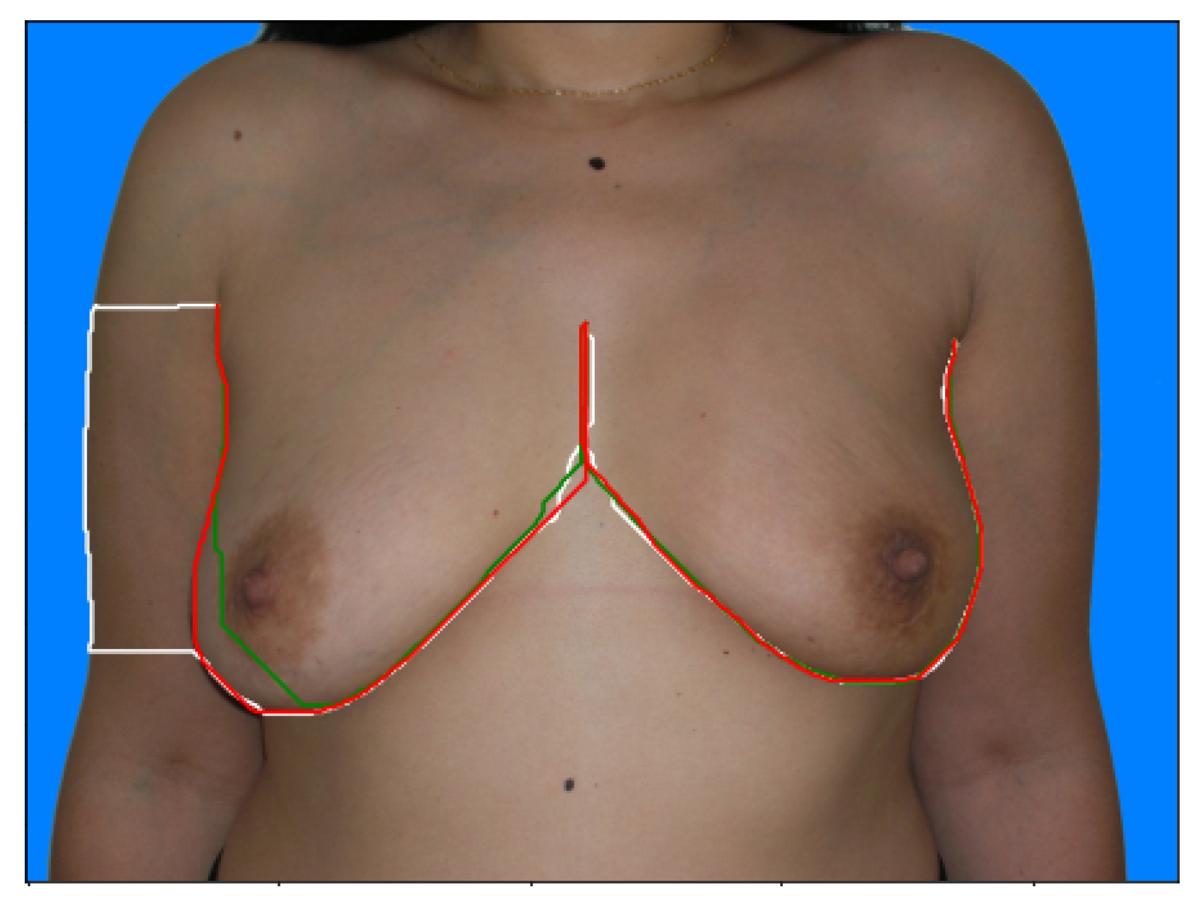 Bioengineering 10 00401 g005