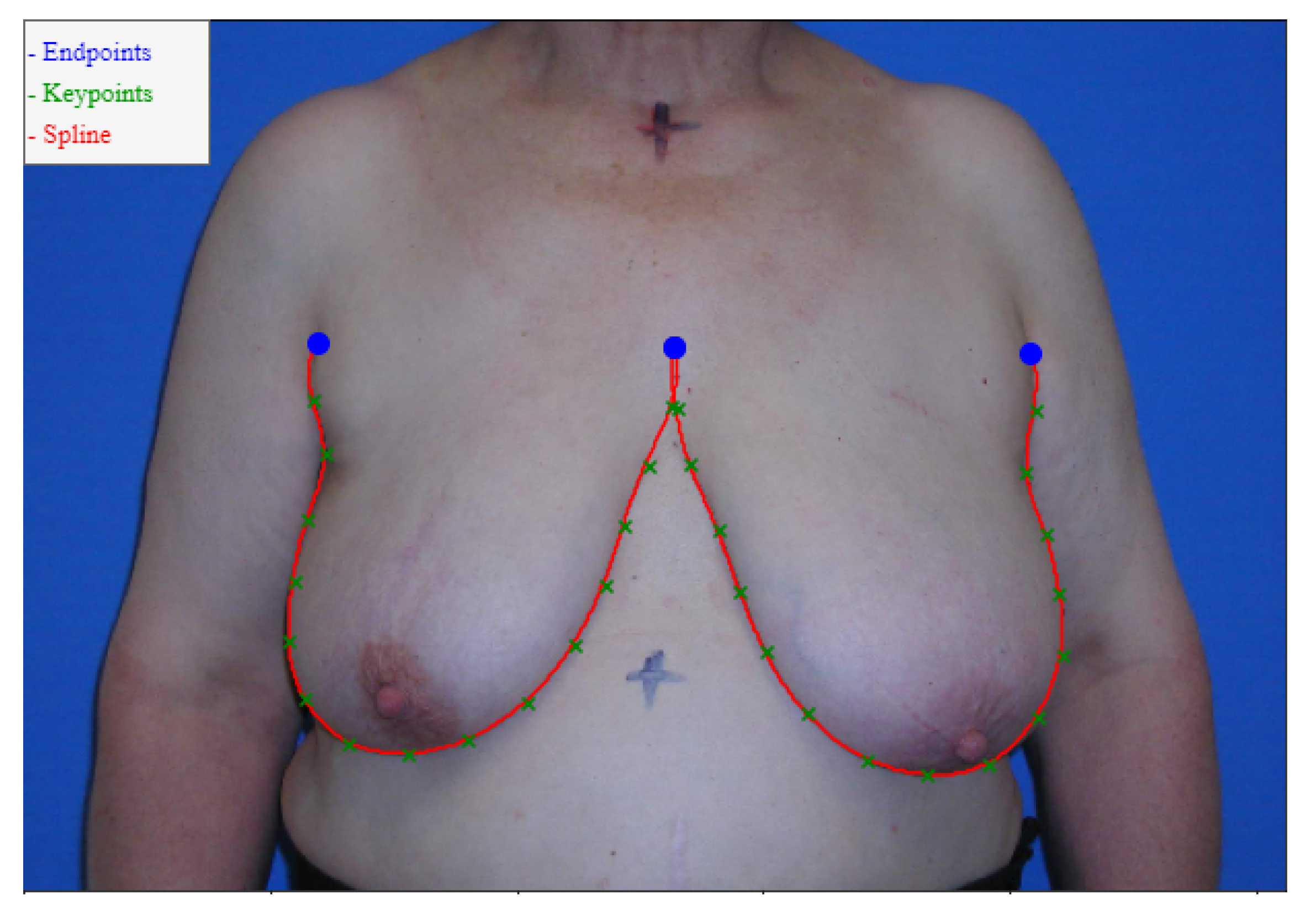 Bioengineering 10 00401 g006