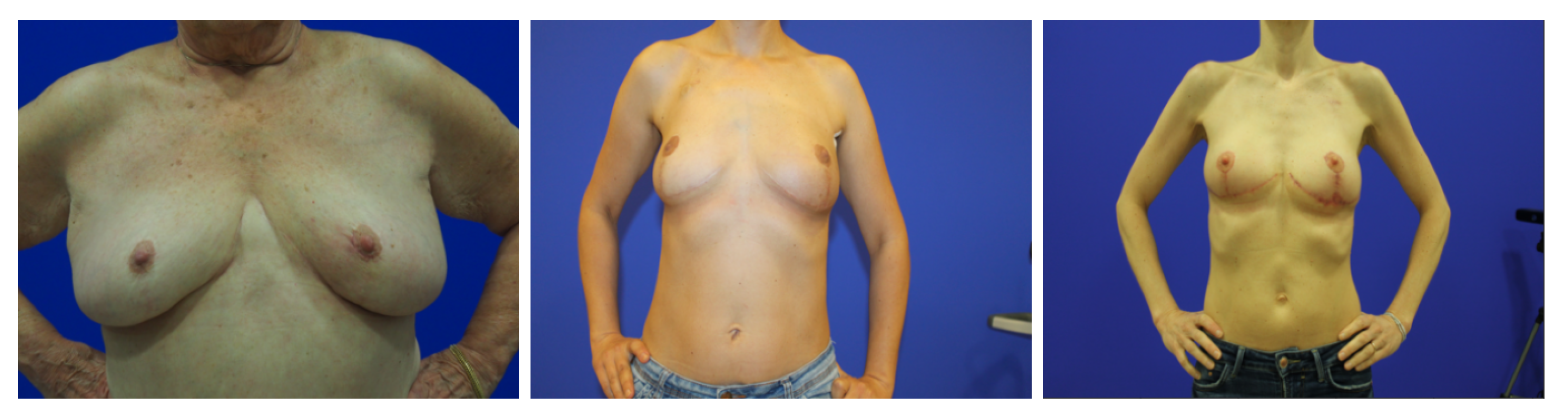 Bioengineering 10 00401 g007