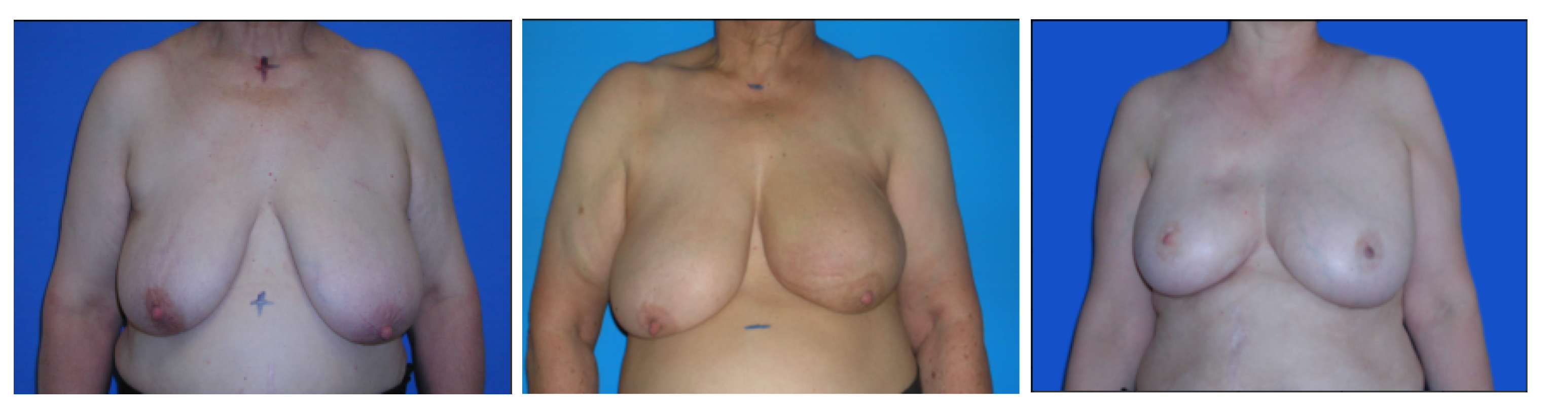 Bioengineering 10 00401 g008