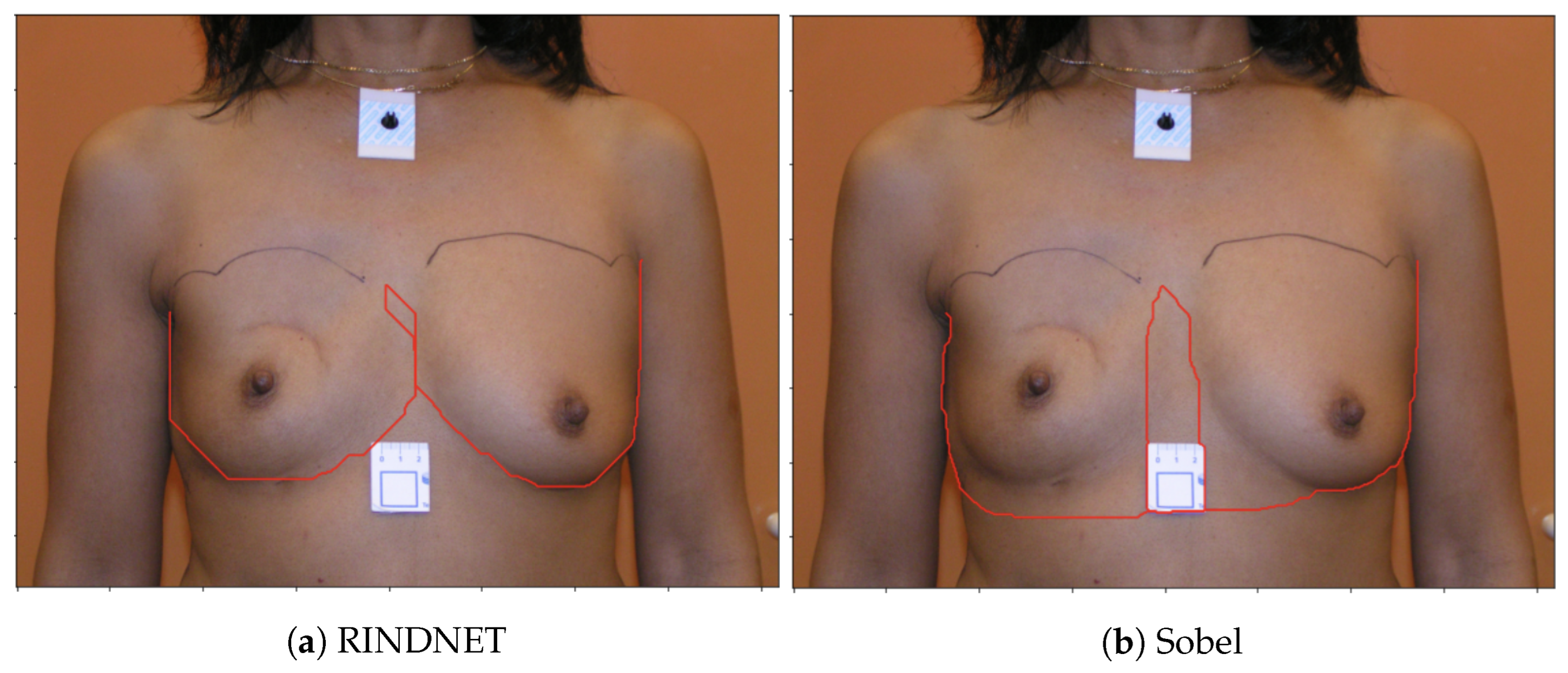 Bioengineering 10 00401 g009