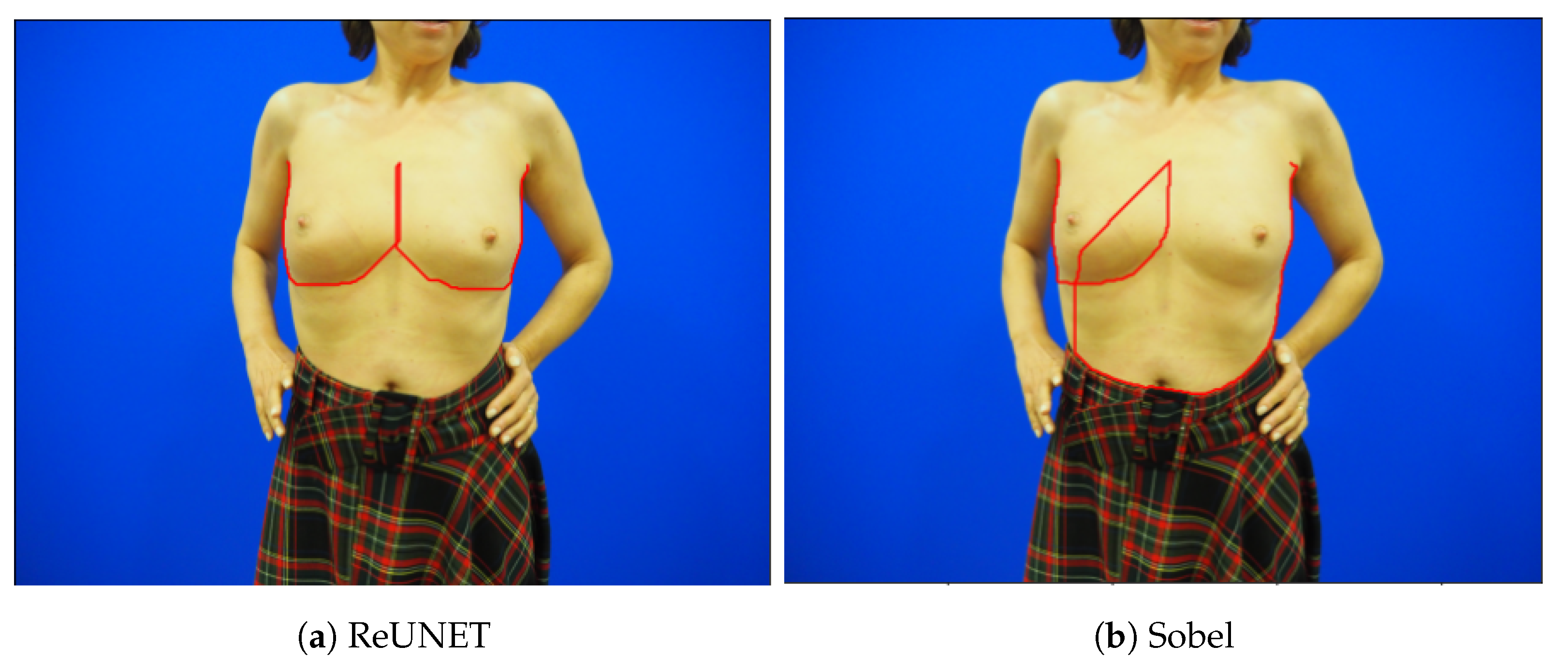Bioengineering 10 00401 g010