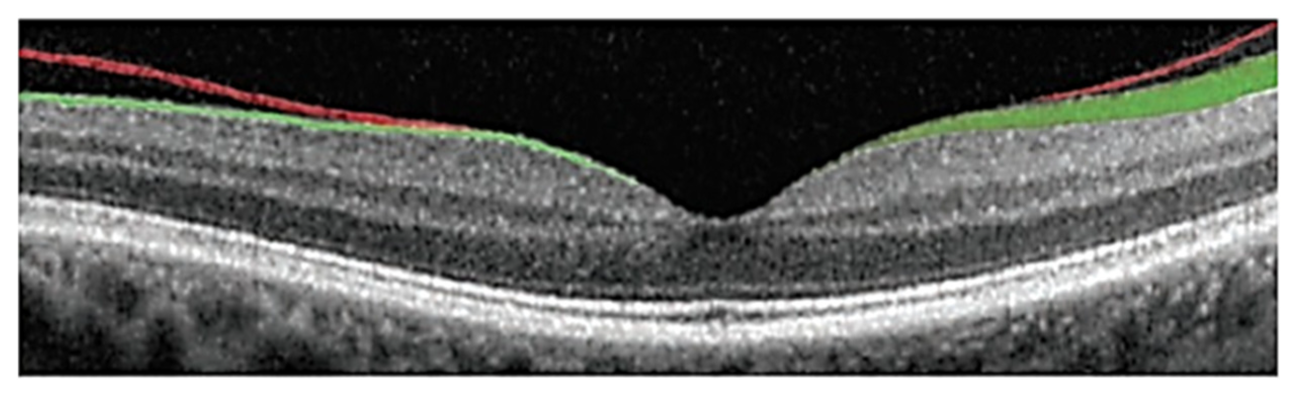 Bioengineering 10 00407 g005 Bioengineering 10 00407 g005