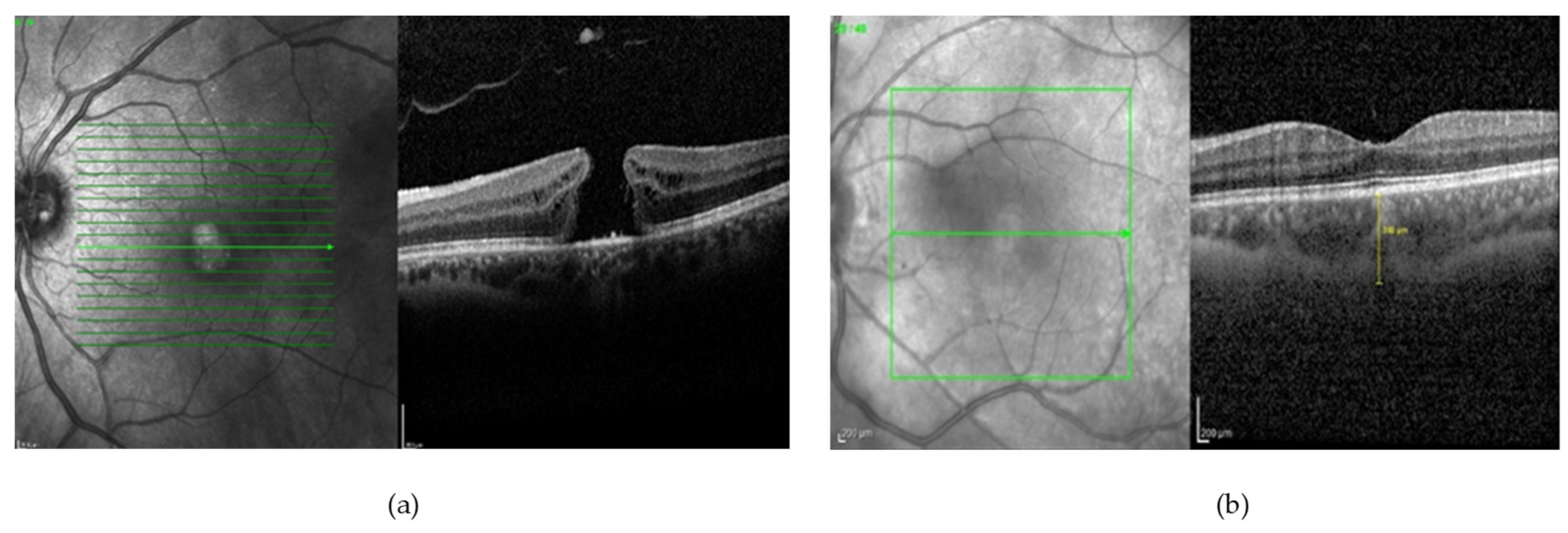 Bioengineering 10 00407 g010 Bioengineering 10 00407 g010
