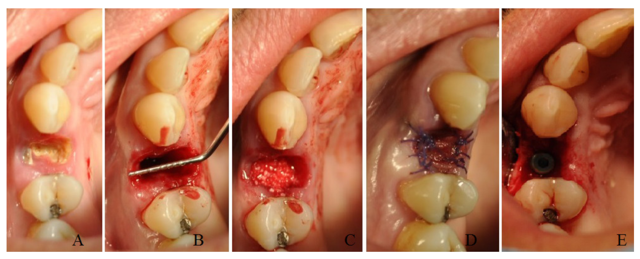 Bioengineering 10 00421 g003