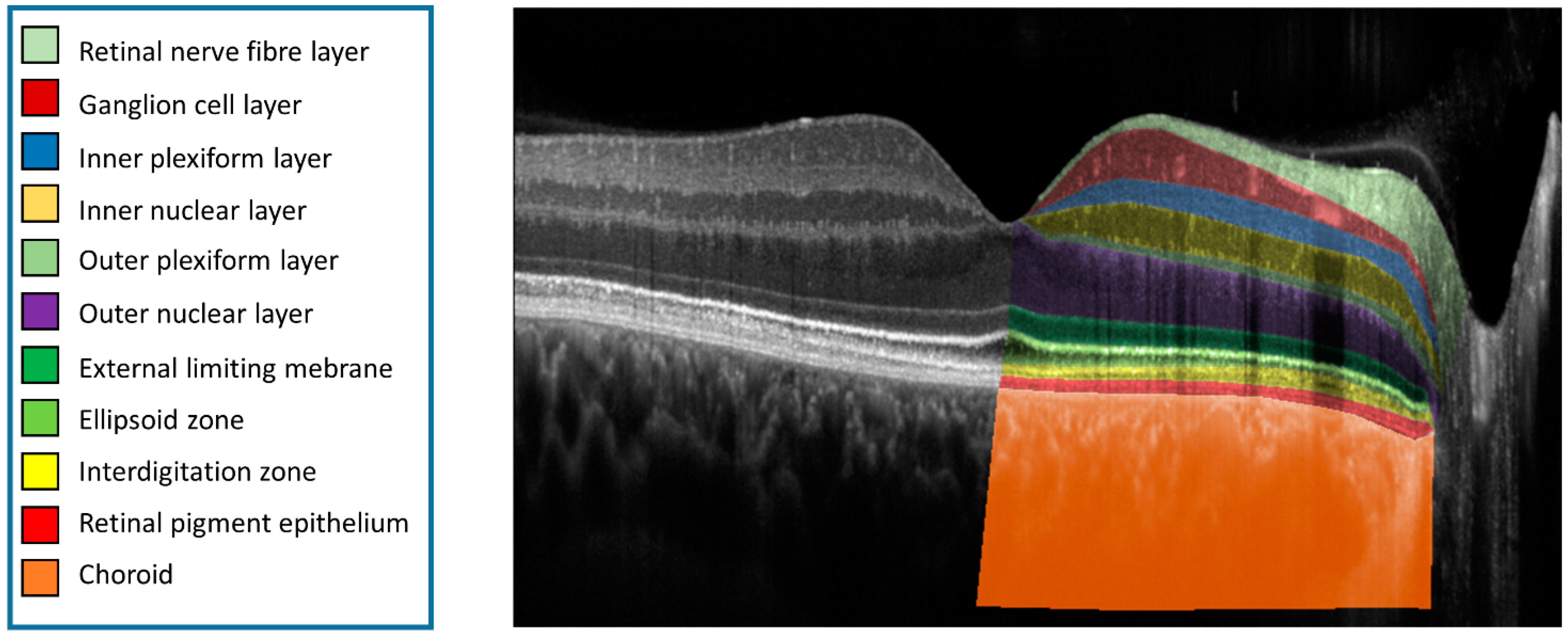 retinal layers oct