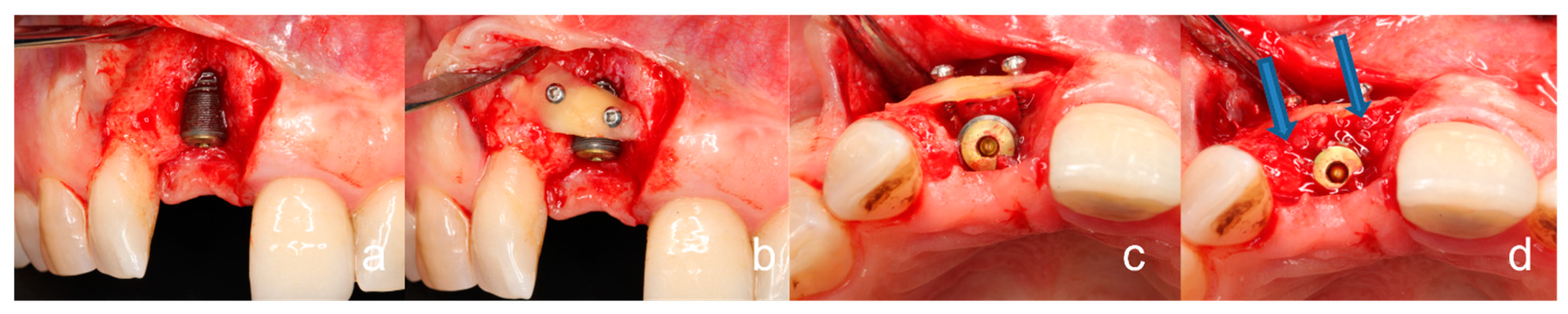Bioengineering 10 00456 g002