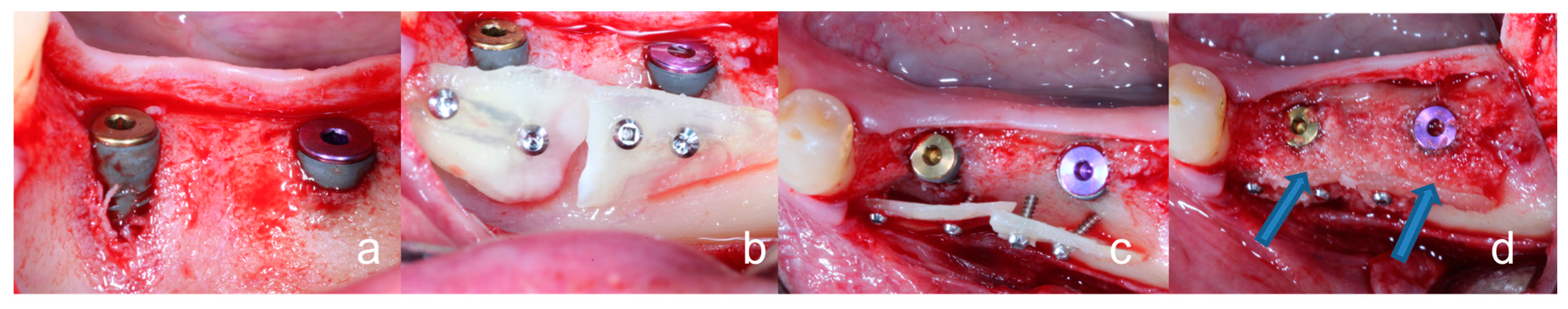 Bioengineering 10 00456 g003