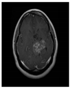 Bioengineering 10 00475 i001