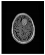 Bioengineering 10 00475 i002