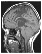 Bioengineering 10 00475 i003