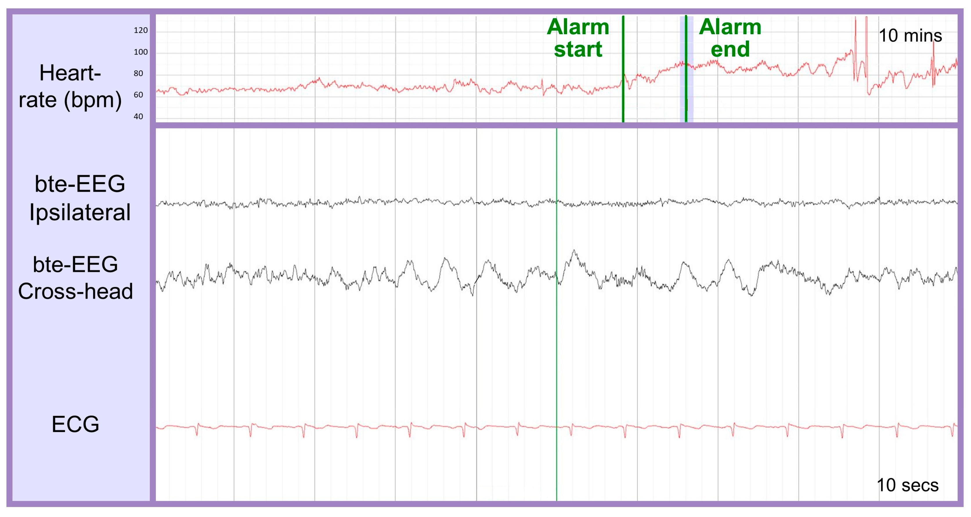 Bioengineering 10 00491 g008