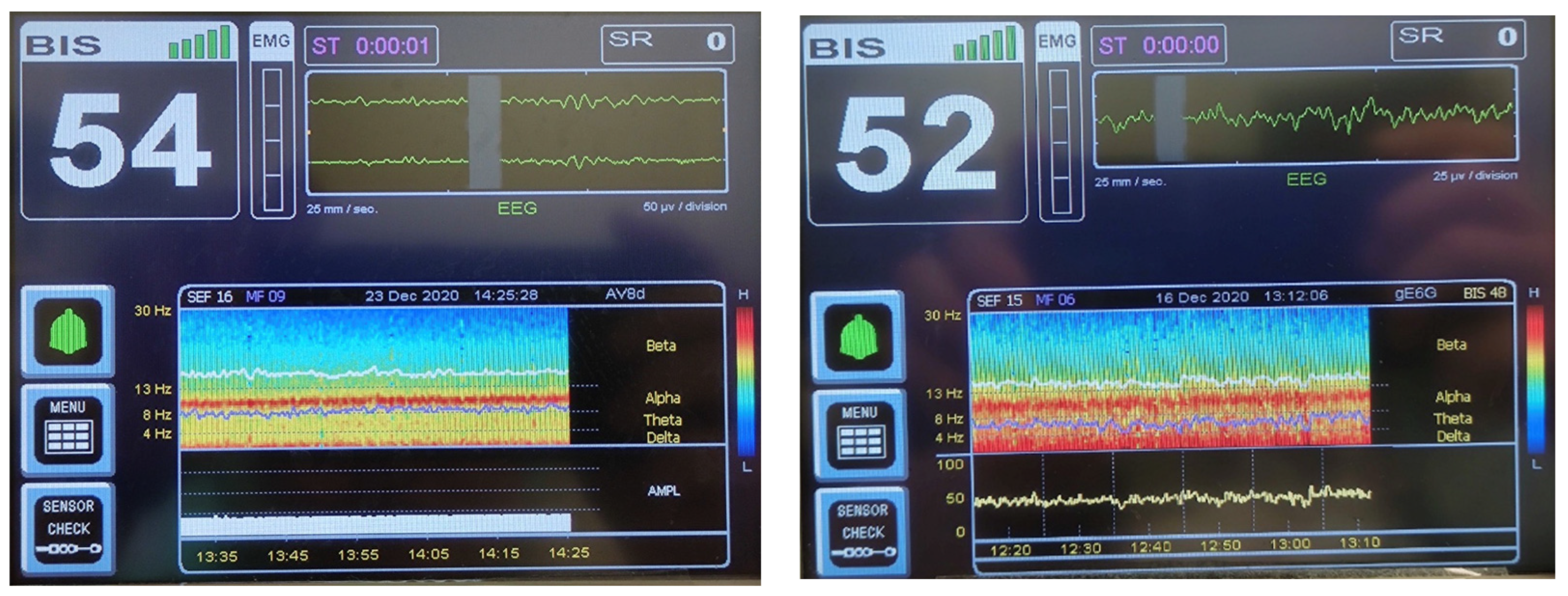 Bioengineering 10 00494 g002