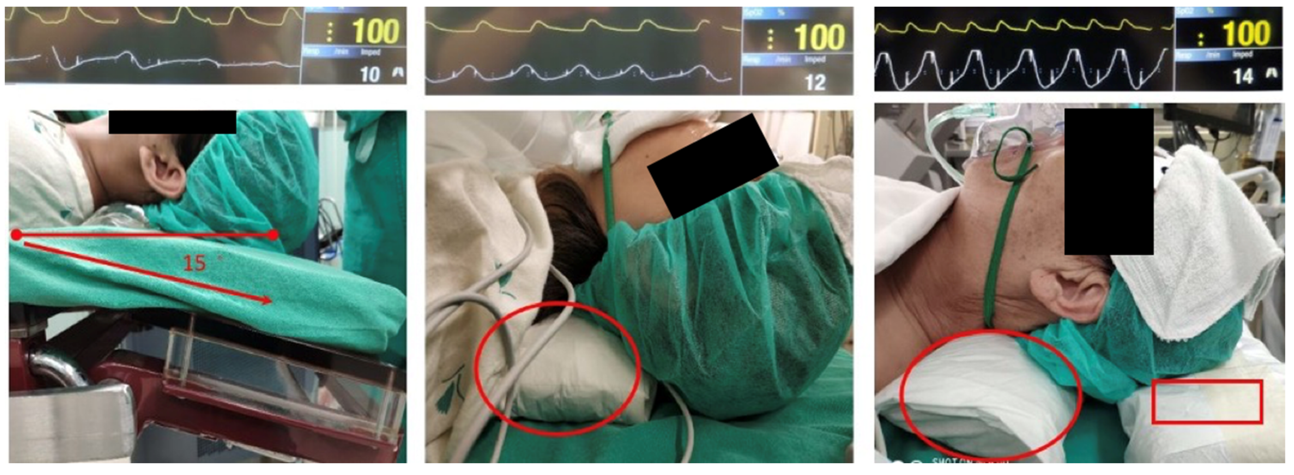 Bioengineering 10 00494 g003