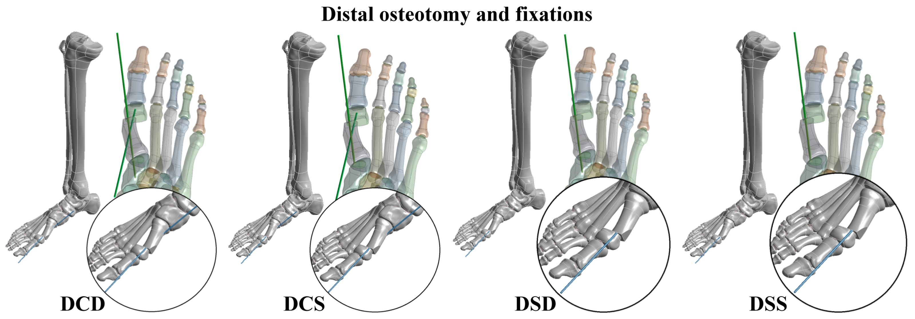 Bioengineering 10 00499 g003 Bioengineering 10 00499 g003