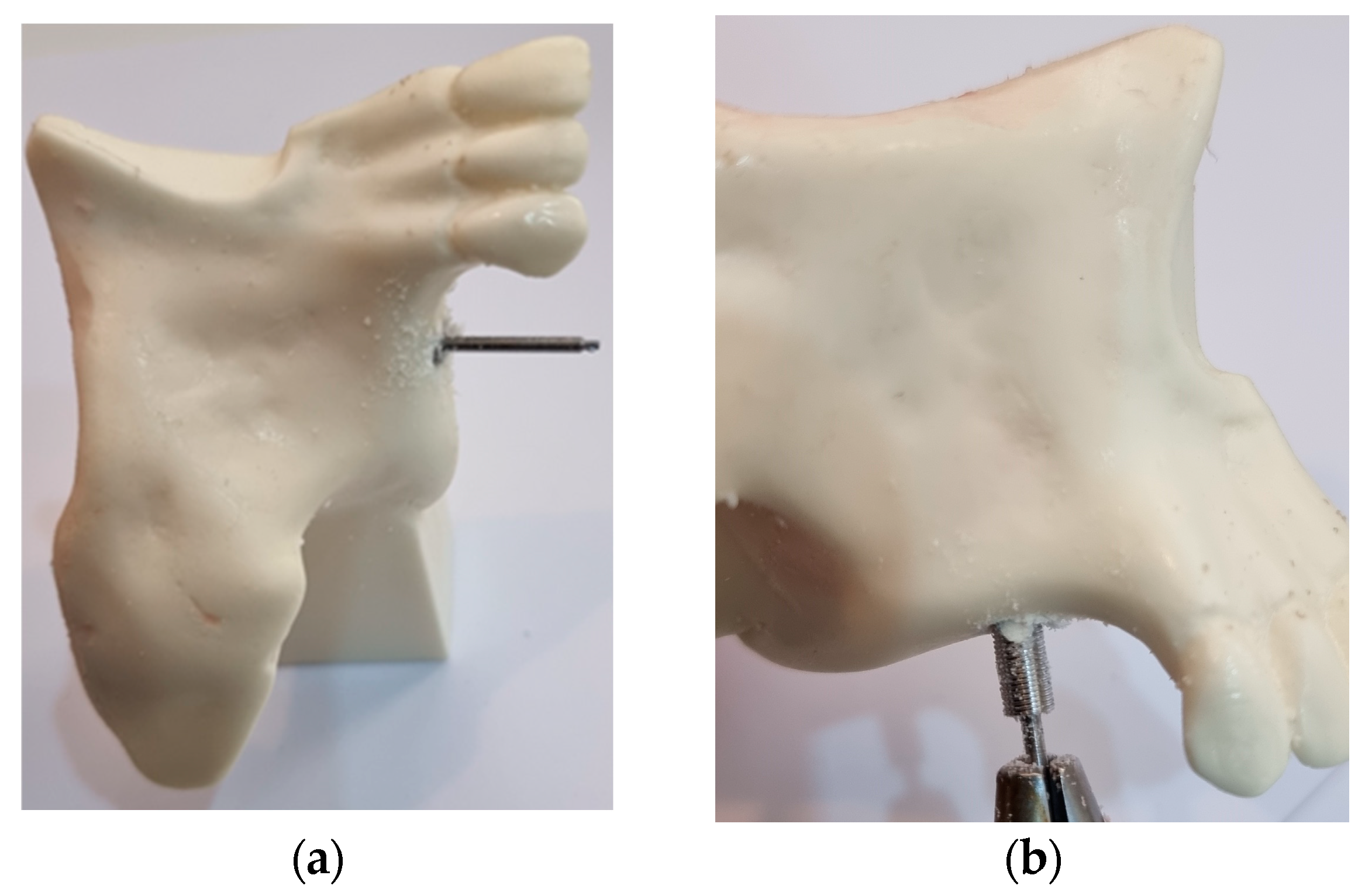 Bioengineering 10 00505 g002