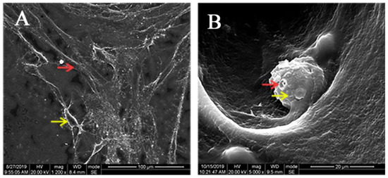 Hdpcs Cell Mechanism of Pulp Regeneration Based on Concentrated Growth Factors ...