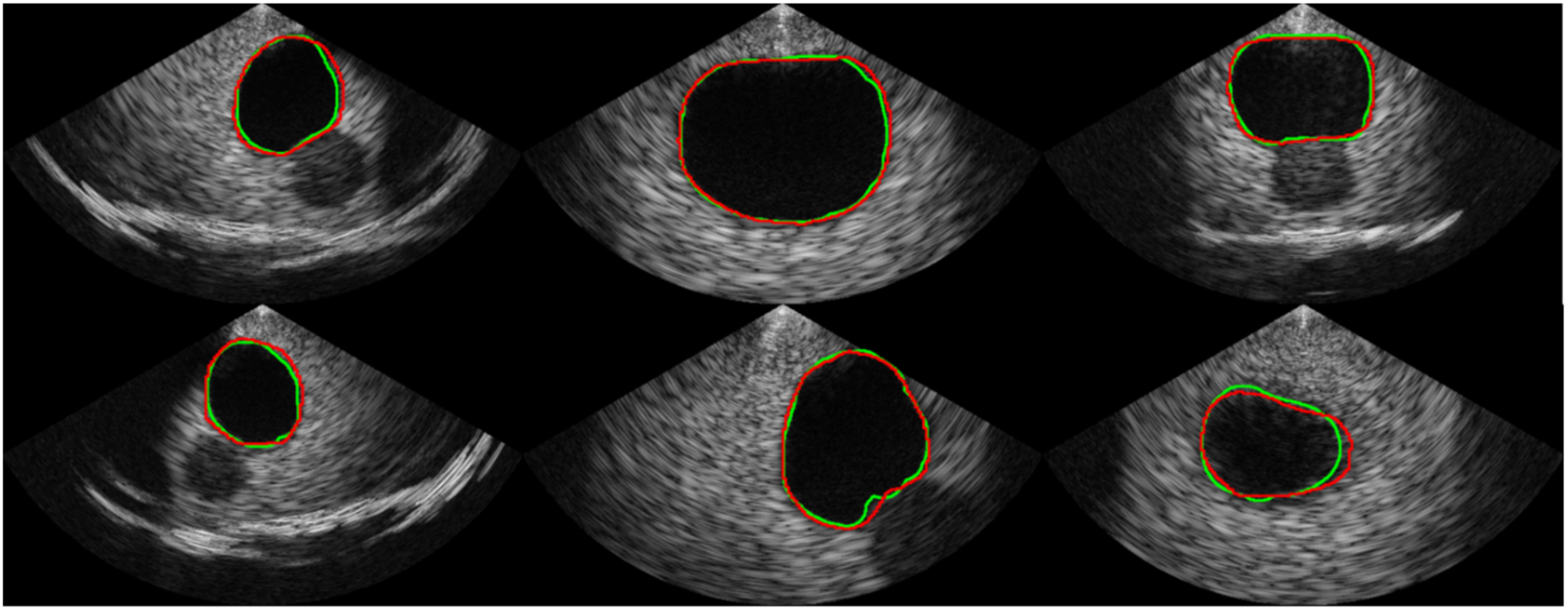 Bioengineering 10 00525 g006
